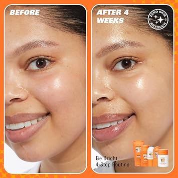 Revolution Skin, Be Bright 4 Step Starter Kit, Brightening Skincare Set Includes Cleanser, Toner, Serum & Moisturiser, Vegan & Cruelty-Free, 4 Products Included