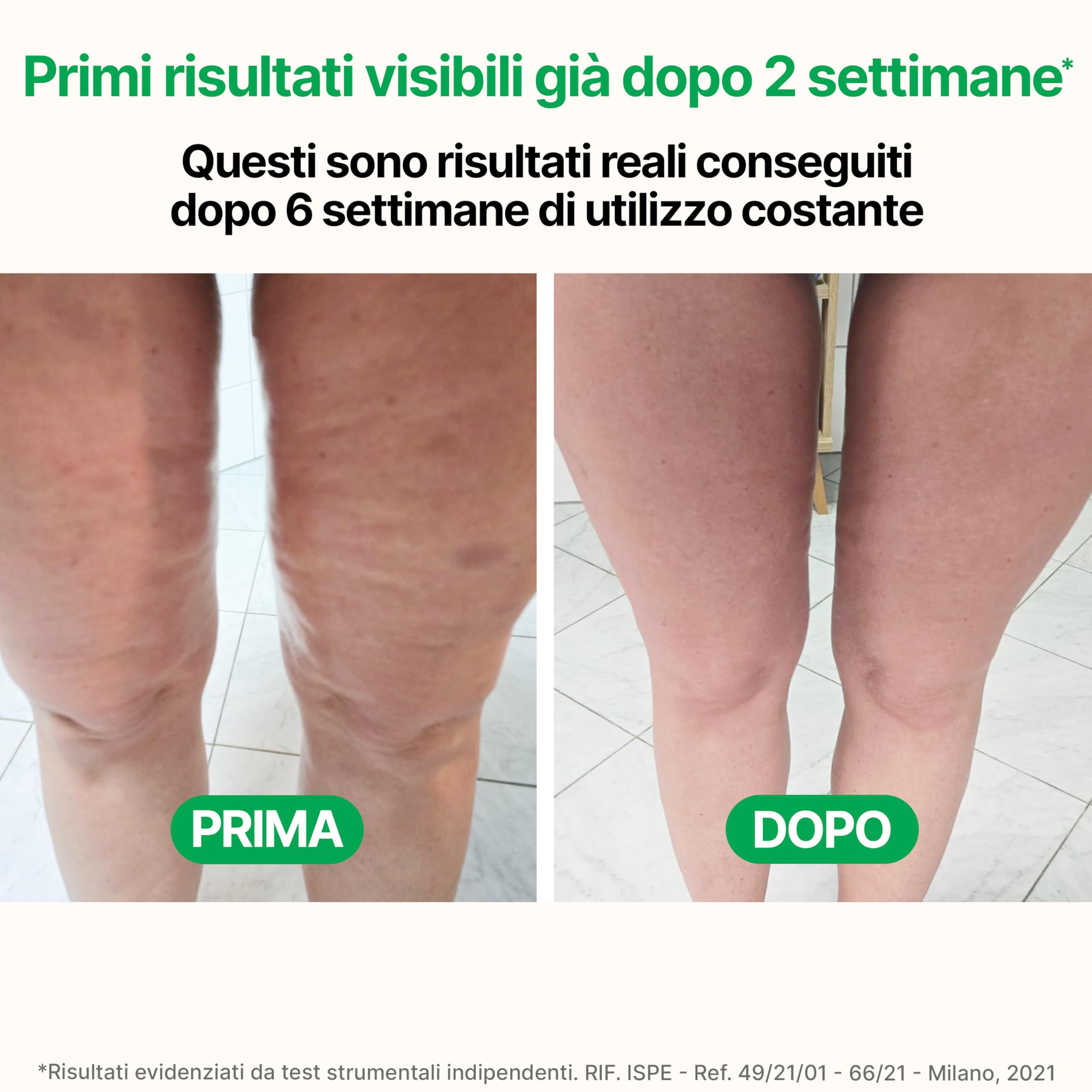 TESMED CELLULITE Massaggiatore Anticellulite Brevettato – Rassodante e Snellente per Gambe, Glutei e Cosce – Made in Italy
