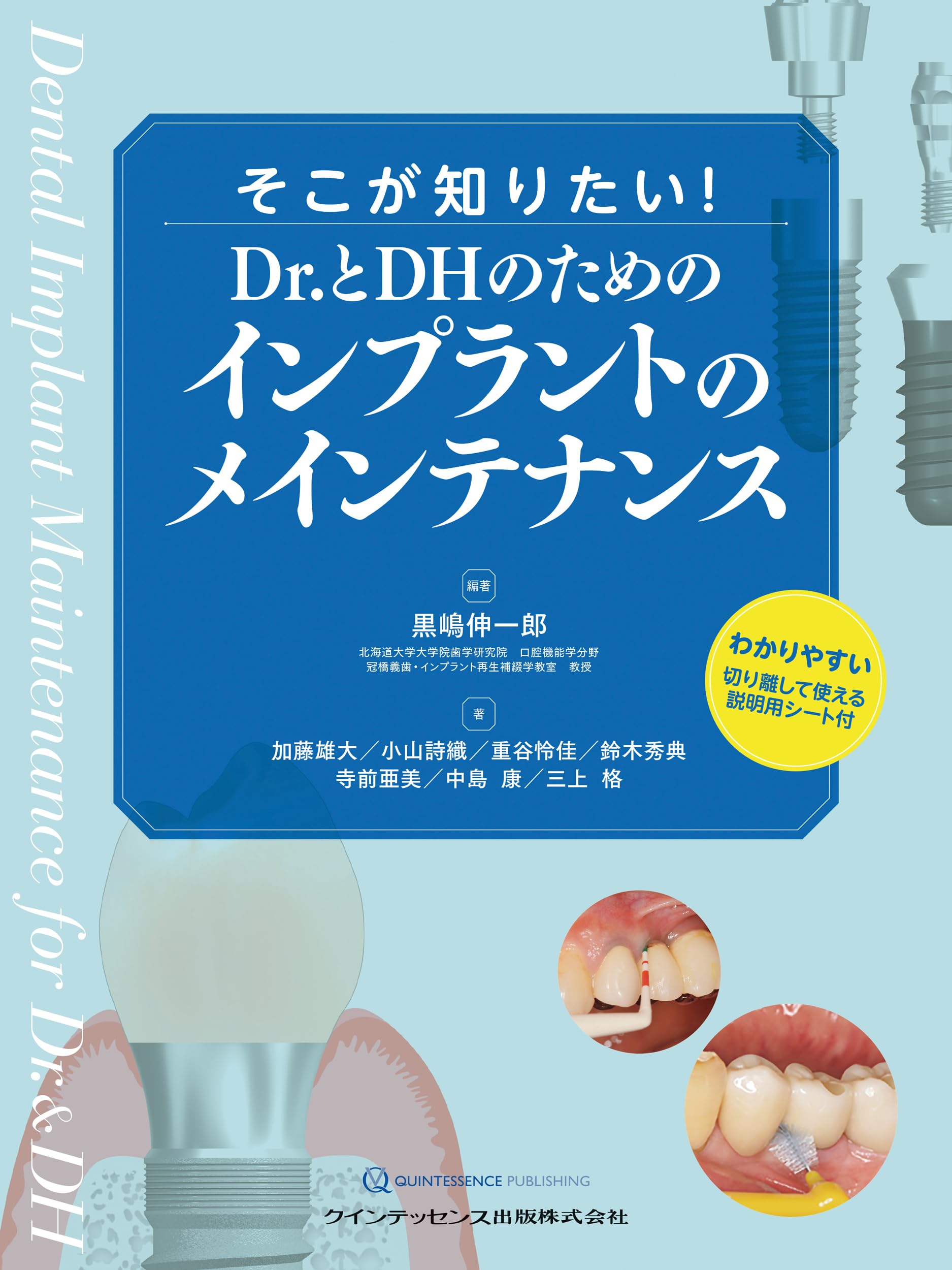 【４月新刊】そこが知りたいDr.とDHのためのインプラントのメインテナンス　歯科 そこが知りたい! Dr.とDHのためのインプラントのメインテナンス | 黒嶋