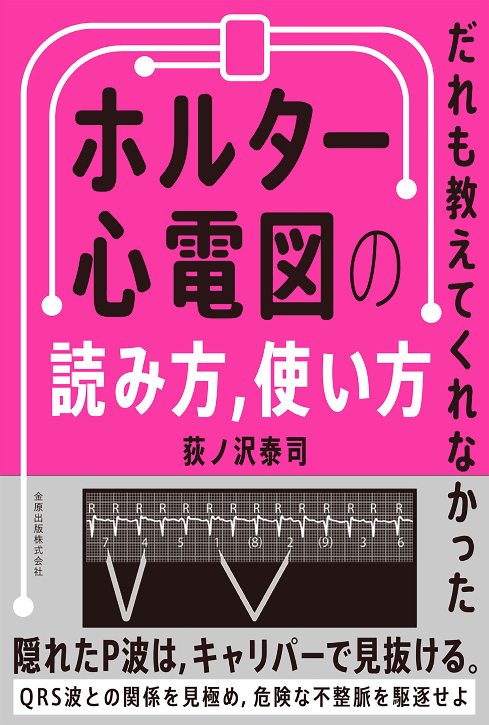だれも教えてくれなかった ホルター心電図の読み方，使い方 | 荻ノ沢