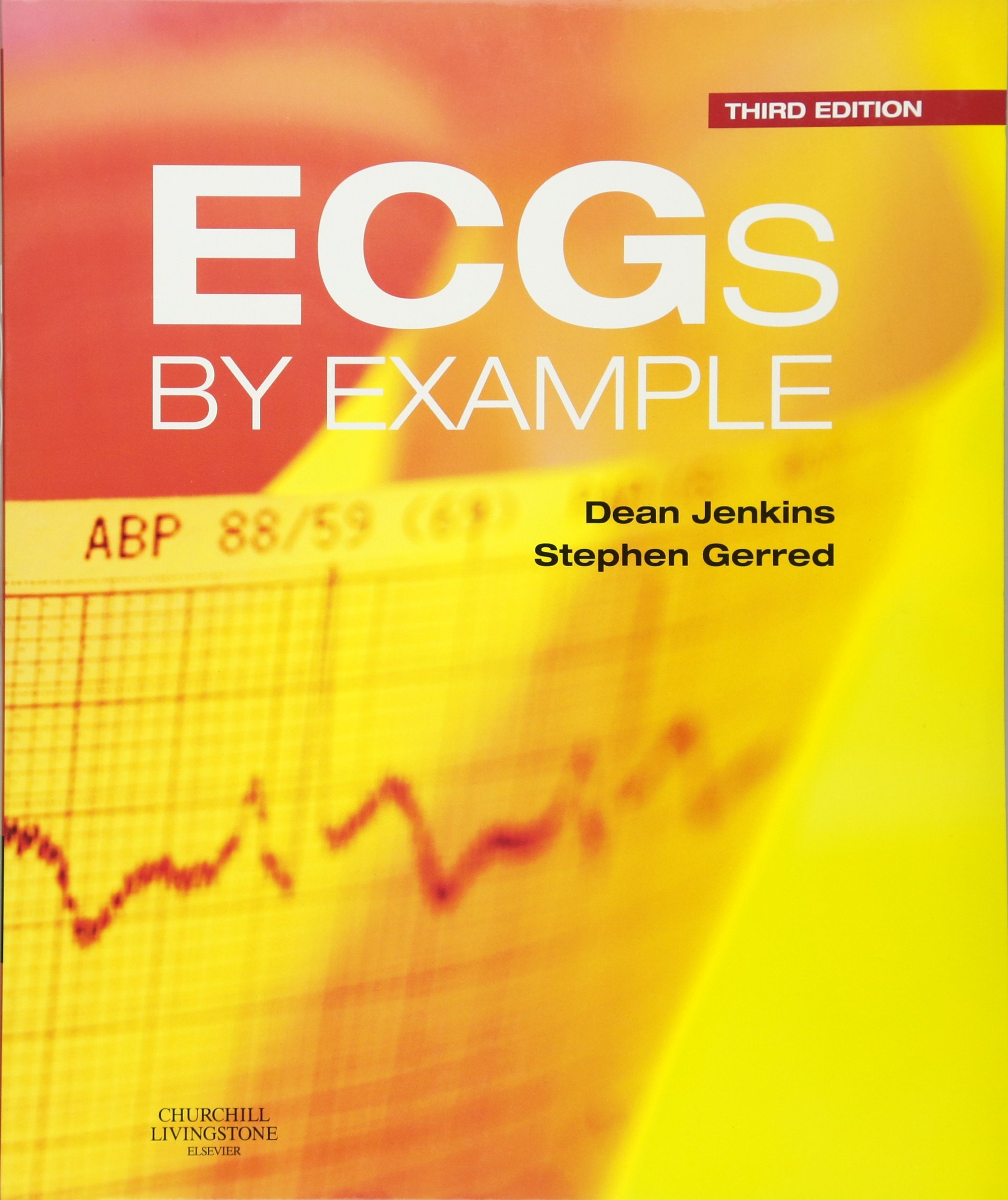 ECGs by Example