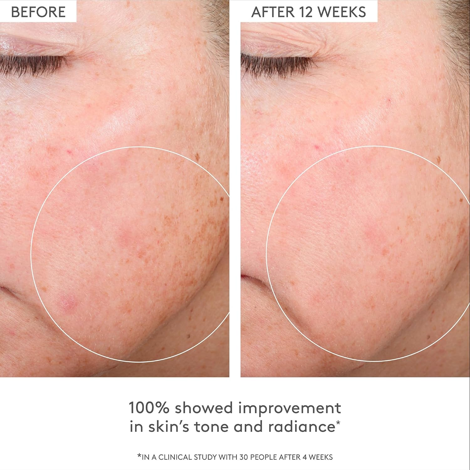 Drunk Elephant C-Firma Fresh Day Serum - 28 ml/.94 fl oz - 15% Illuminating Vitamin C - Clean Clinical Skincare - Cruelty-Free - Dermatologist-Tested - Free of Essential Oils, Silicones, and Fragrance