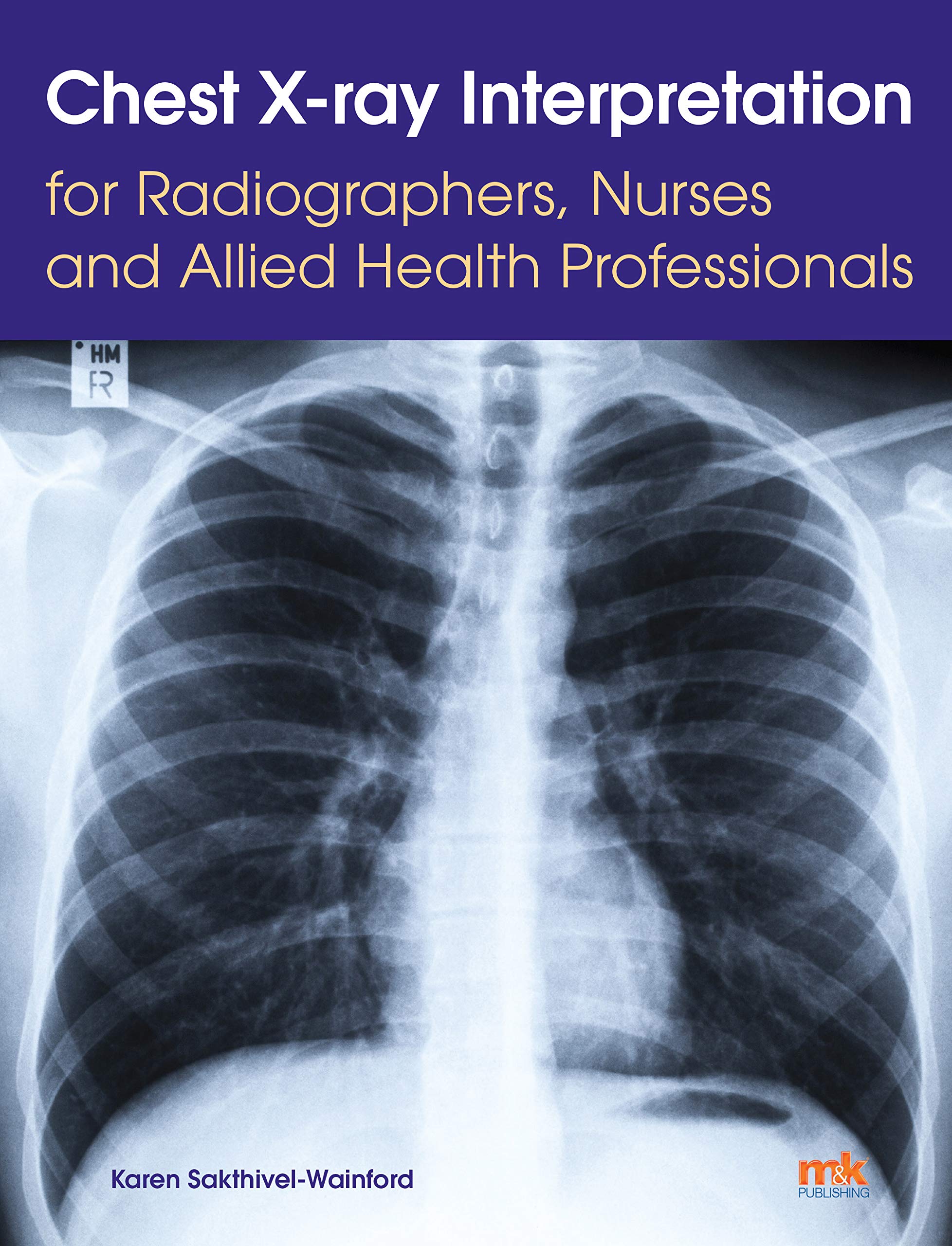 Chest X-ray Interpretation for Radiographers, Nurses and Alli... - 9781910451274