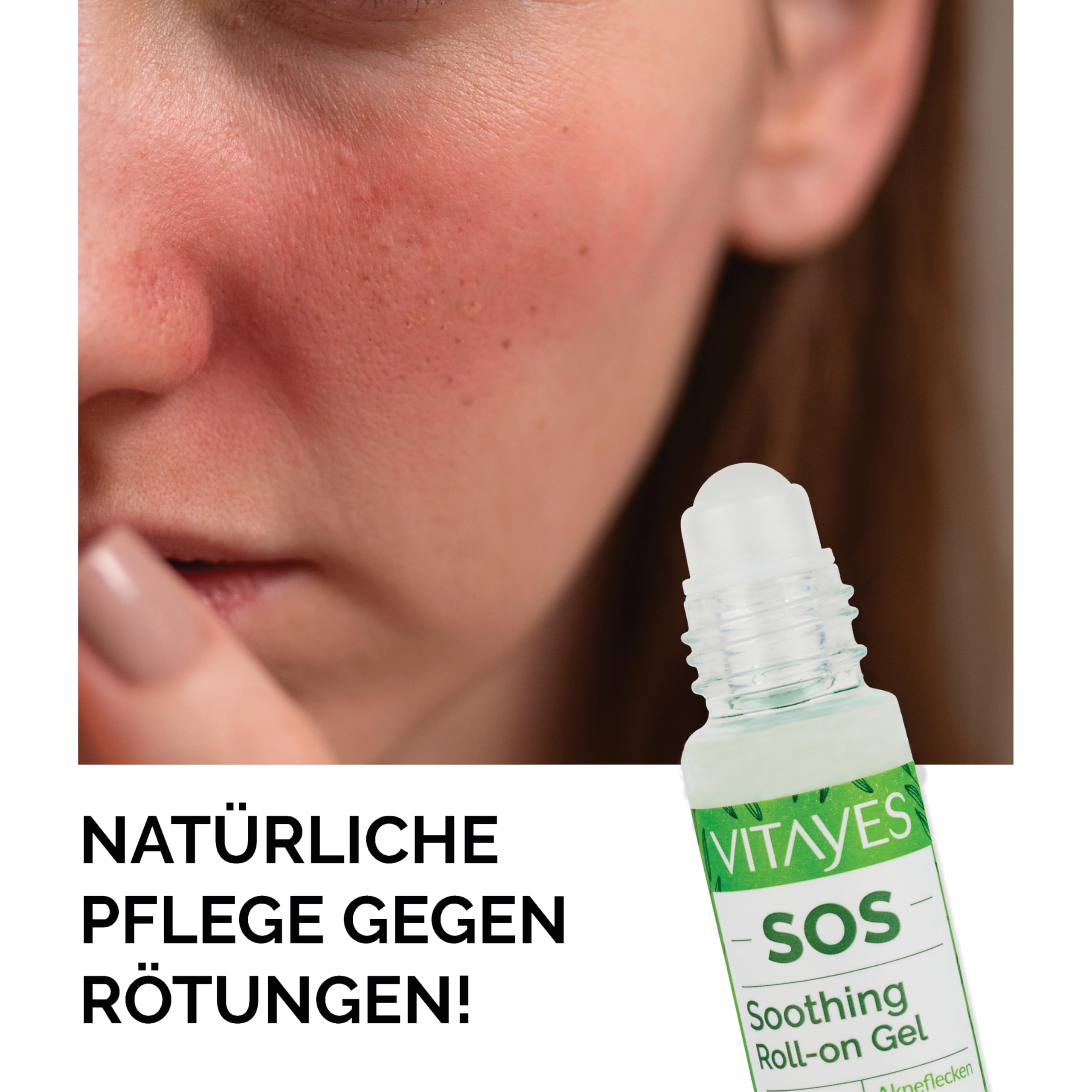 Vitayes SOS BIO Teebaumöl Roller 3x10 ml – Ätherisches Öl gegen Pickel, Akne & Hautunreinheiten – Roll-on Stift mit Vitamin B5 – Vegan & Tierversuchsfrei