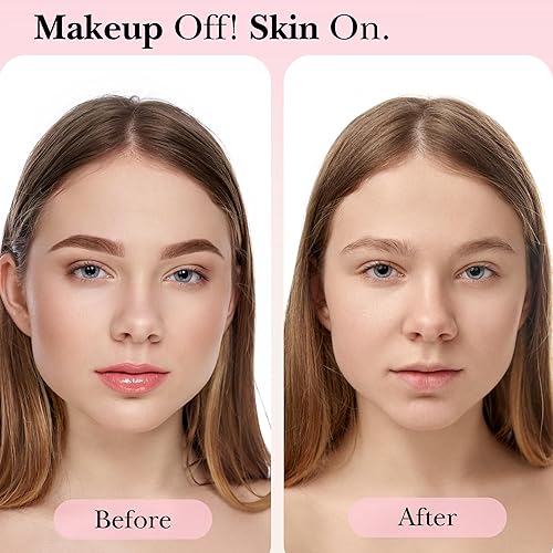 Miniatura 5 de mivida Toallitas desmaquillantes hipoalergénicas con vitamina E  4 x 50 unidades en total 200 toallitas para eliminar maquillaje a granel  Toallitas