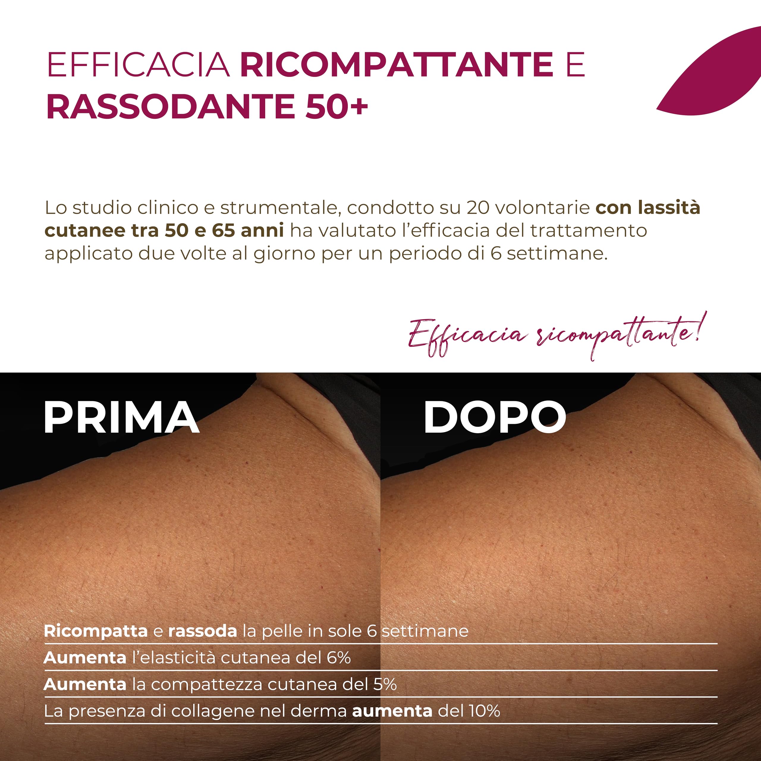 Iodase Crema Corpo Ricompattante 200ml, Pelle Tonica e Compatta, con Collagene e Oli Naturali Attivati, Migliora Elasticità, Densità e Compattezza, Ideale per Pelli Mature e Lassità Cutanea