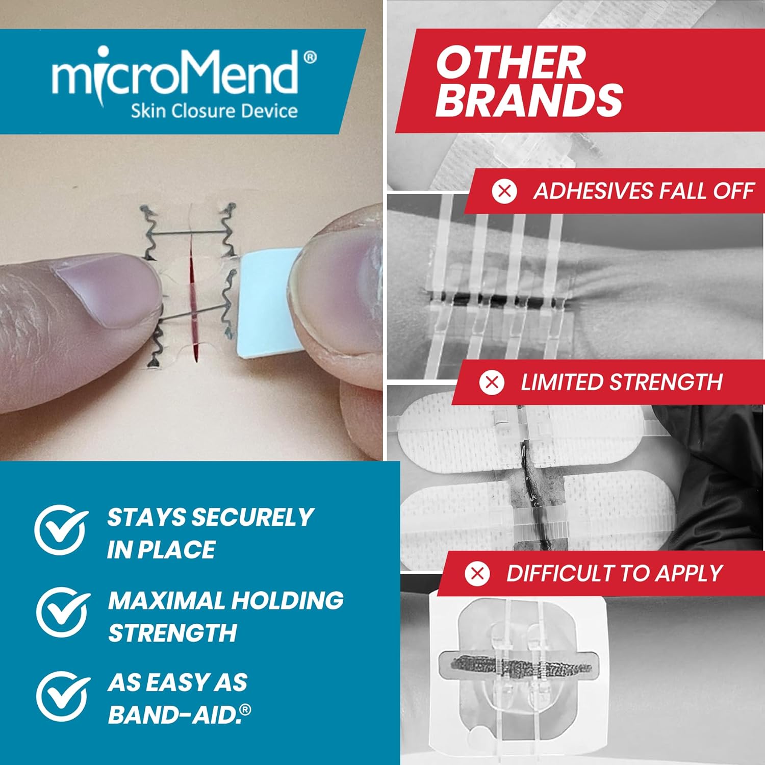 Emergency Wound Closures - Surgical-Grade Laceration Repair Without Stitches | Skin Closure Alternative to Butterfly Bandages | First Aid Kit Essential (6 Medium Wound Closure Devices)