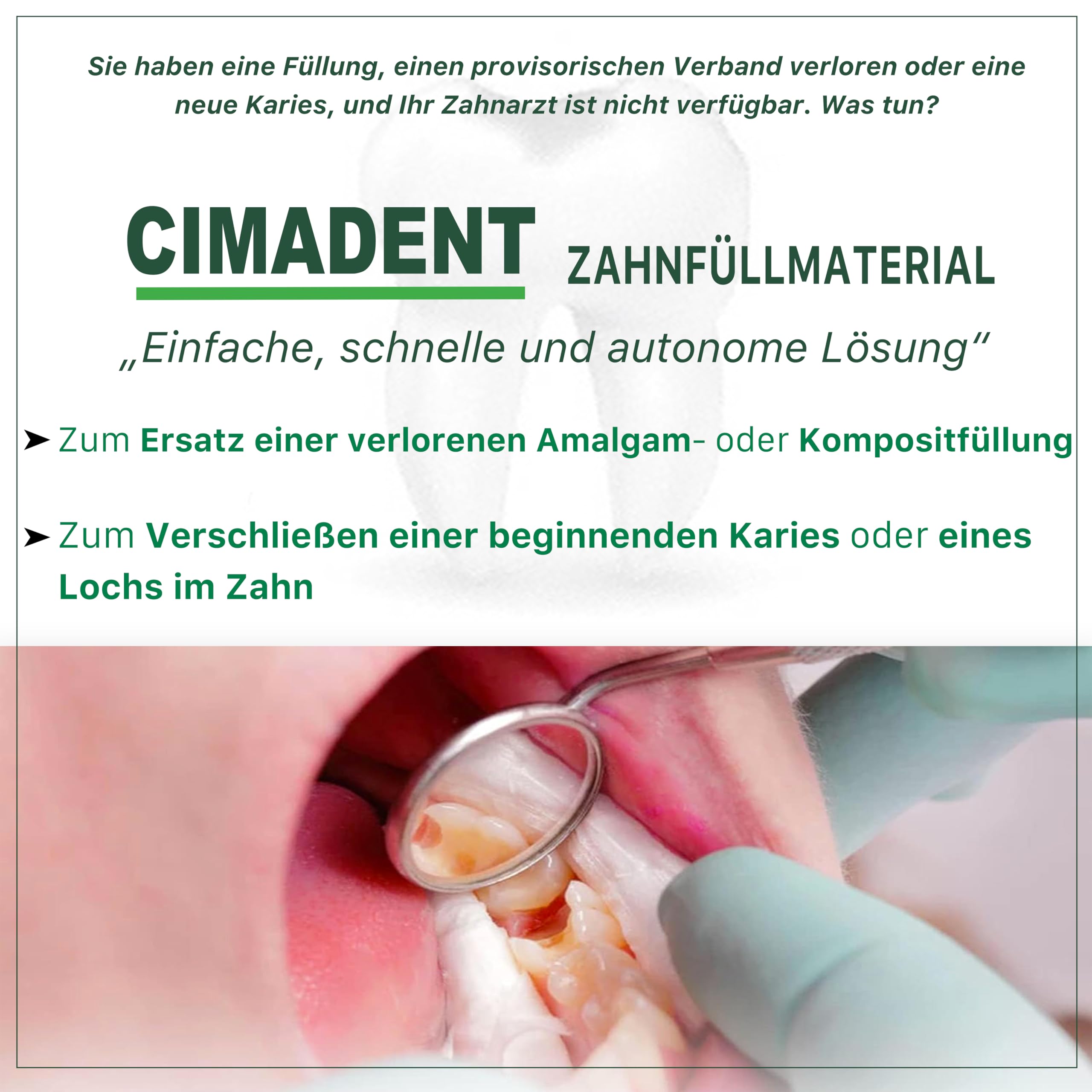 Zahnpflege Cimadent für Verstopfung von Karies oder verlorener Füllung. Ausgezeichneter temporärer Verband, während Sie auf den Zahnarzt warten. 30 Anwendungen