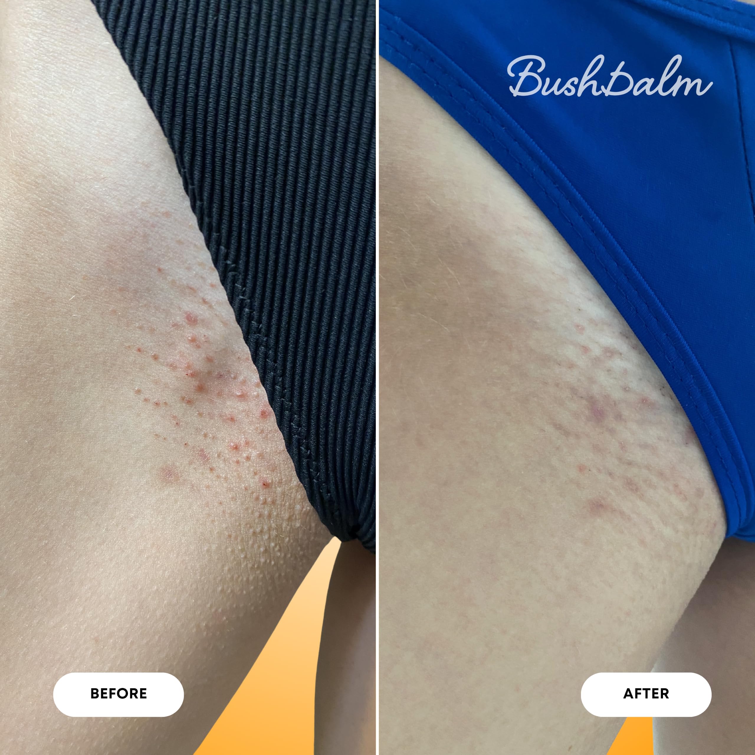Bushbalm 2-stopniowa rutyna dla szorstkiej skóry - miękki, rozkloszowany olejek do włosów (30 ml) i delikatny peeling złuszczający (236 ml)