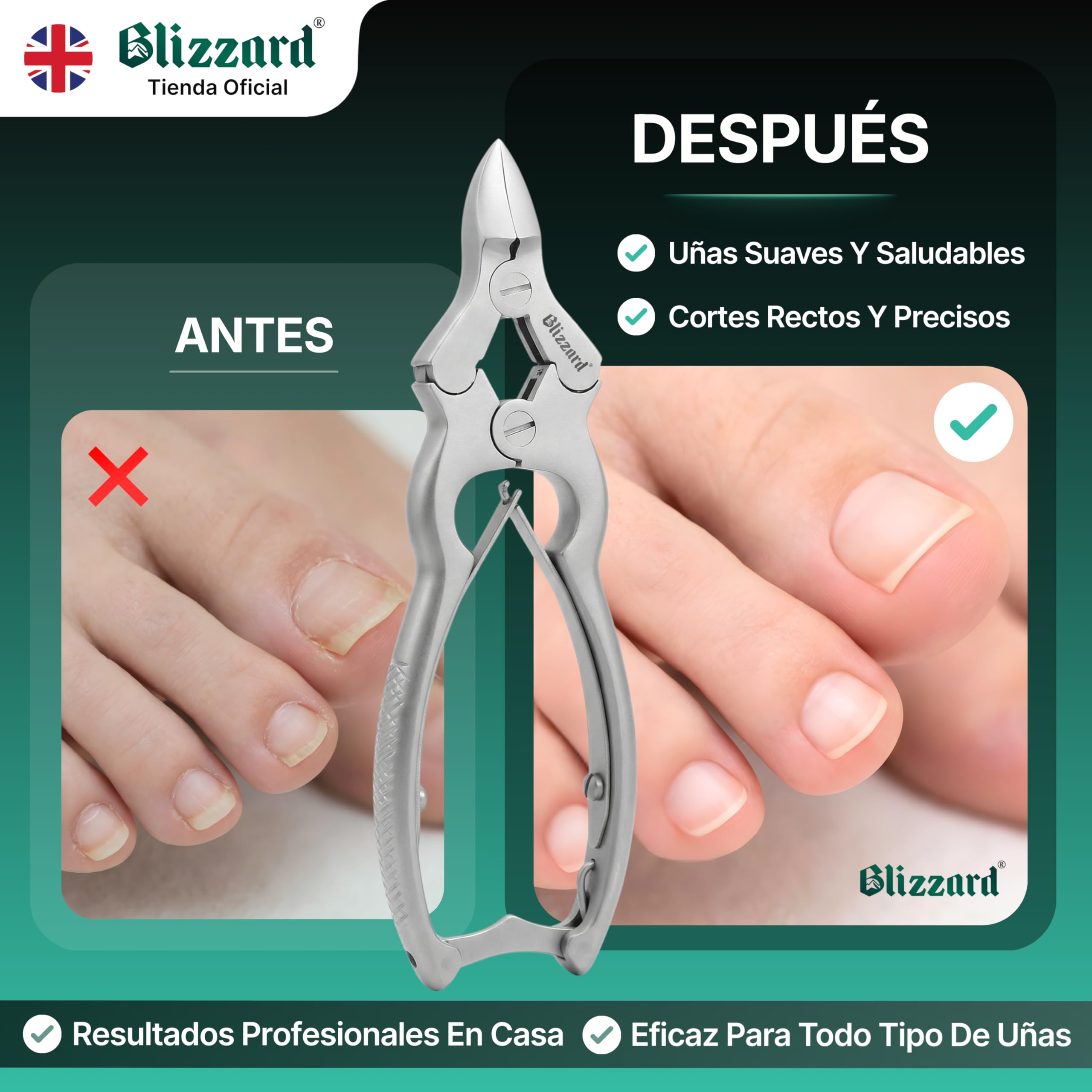 Blizzard Alicates Cortauñas Profesional para Pies - Corta Uñas de Alta Resistencia Triple Articulación para Uñas Gruesas y Encarnadas - Acero Inoxidable Grado Podología con Lima - 15cm Resorte Doble