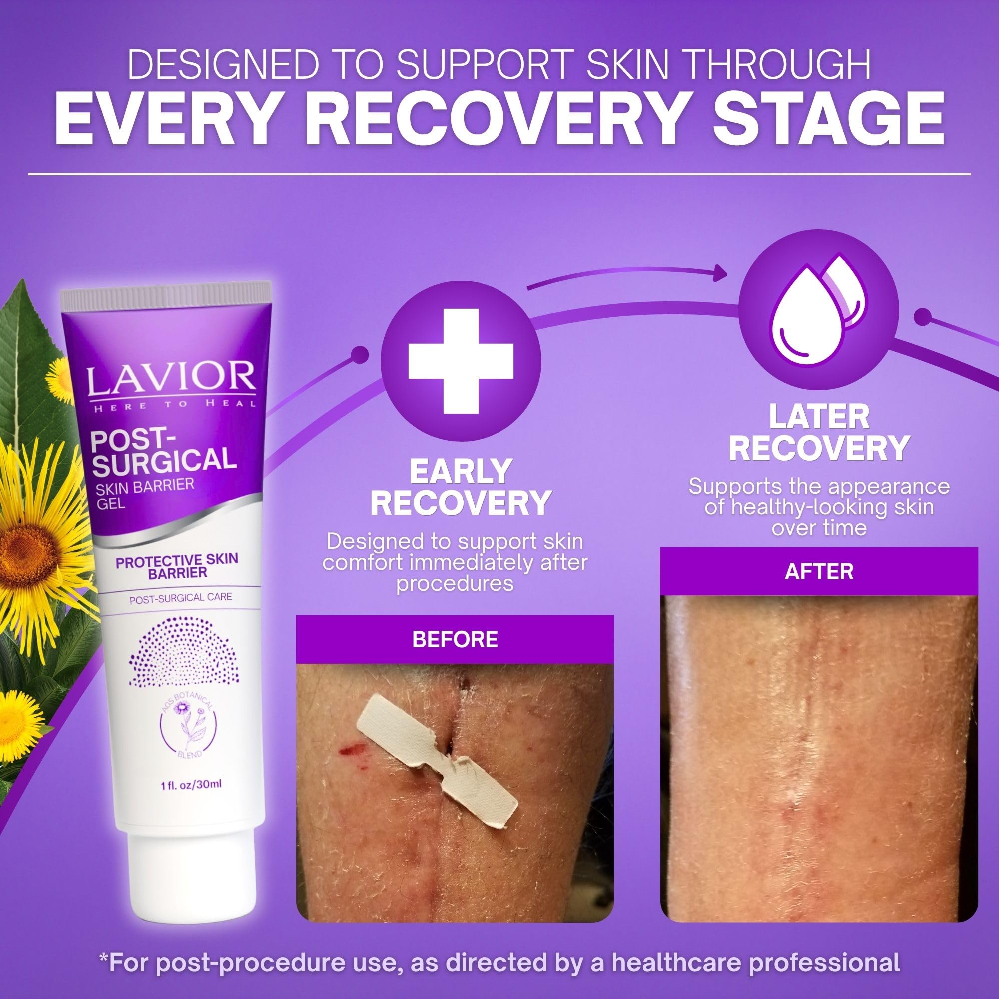 LAVIOR Botanical Gel post-quirúrgico (28,3 g) – Cuidado de recuperación de incisiones – Cuidado suave a base de plantas – Sin silicona