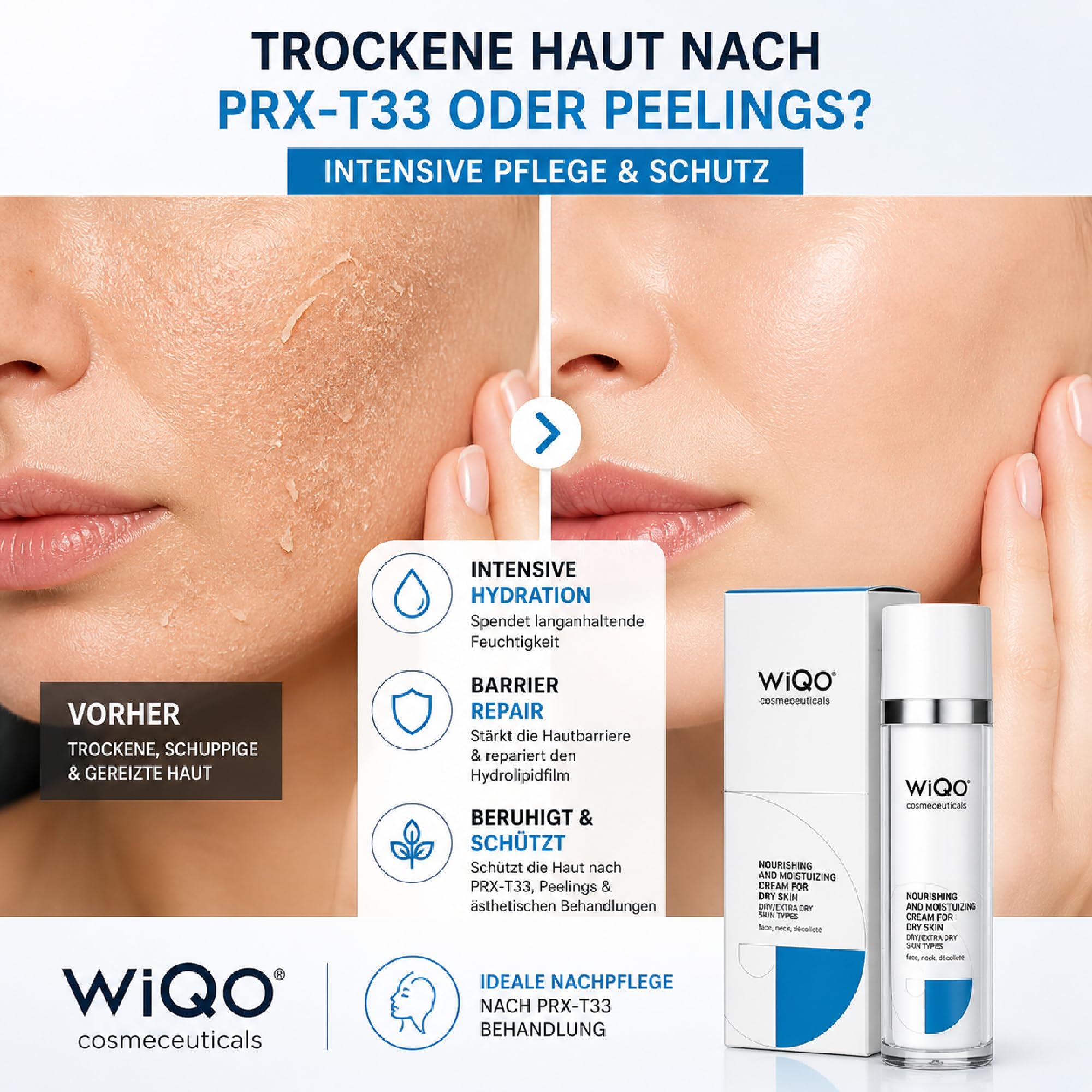 WiQo Moisturizing Face Cream 50ml – Feuchtigkeitscreme für trockene Haut – PRX-T33 Nachpflege, Repair, Hydration, Gesicht Hals Dekolleté