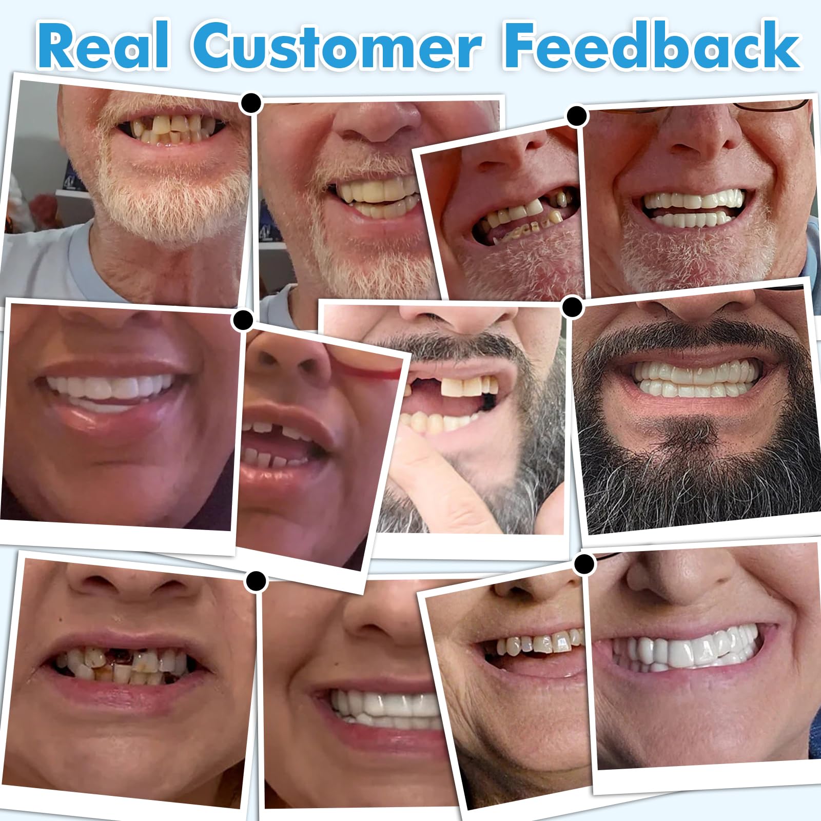 Photo 1 of Smilify Clip On Veneers for Men & Women - [3 Shades & 2 Styles] Custom Fit Temporary Smile Accessory, Natural Cosmetic Teeth Covers, Reusable Personalized Upper and Lower Veneers Set (Top + Bottom)