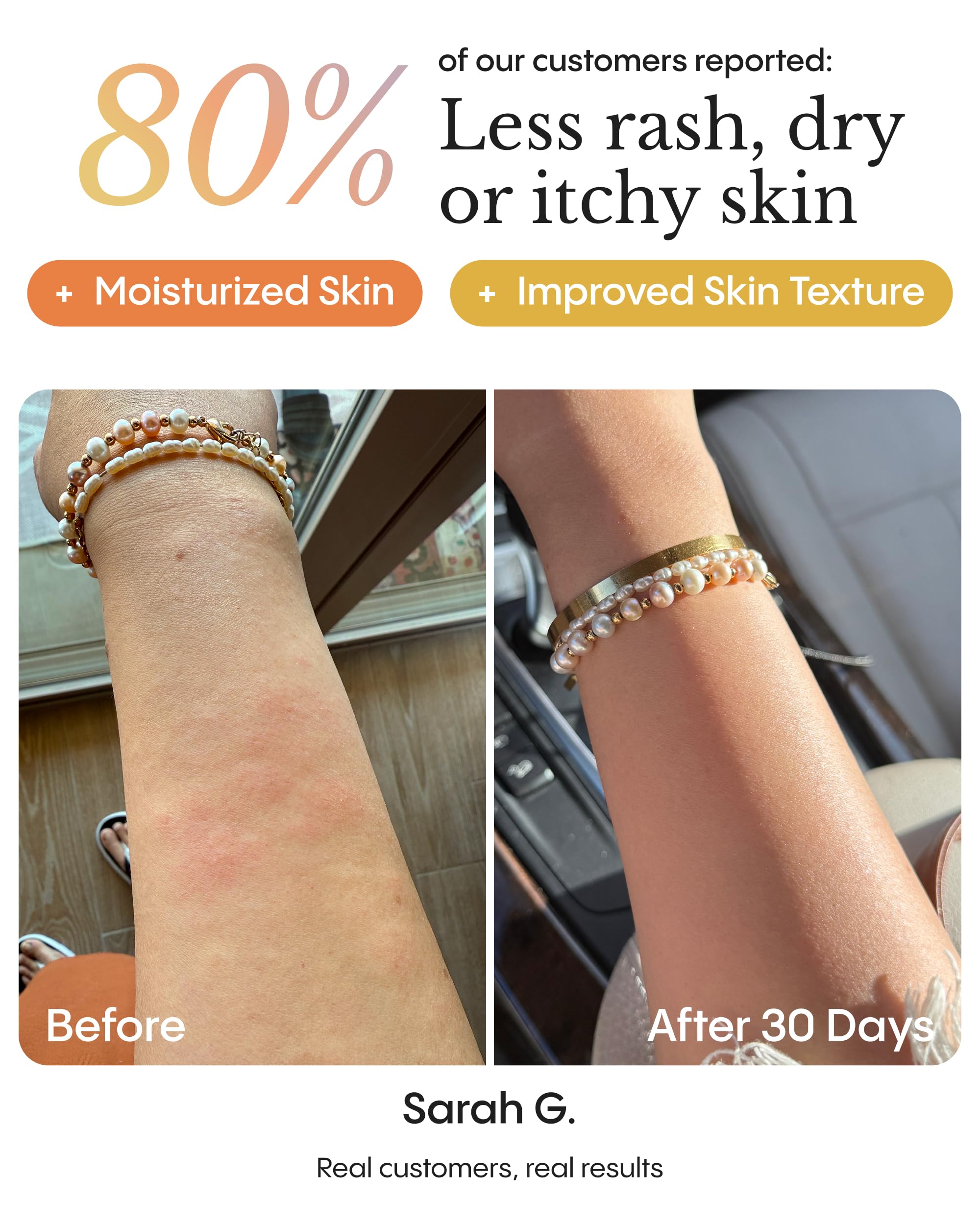 FRØYA Organics Dry & Itchy Skin Soothing Balm for Body & Face, 3.4 fl oz