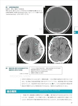 【裁断済み】子どもの口と顔の異常・病変 子どもの口と顎の異常・病変 口の粘膜 編 - クインテッセンス出版