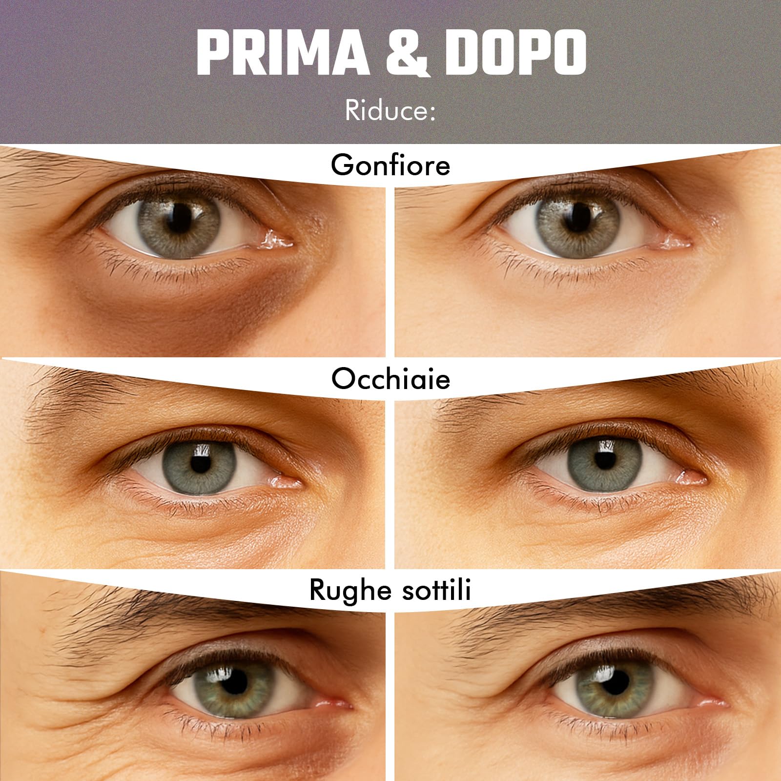 Patch Occhi al Bakuchiol (20 paia), Maschera Occhi con Caffeina, Niacinamide e Acido Ialuronico, Patch Occhiaie e Borse, Maschera Occhiaie, Eye Mask per Schiarente e l'idratazione