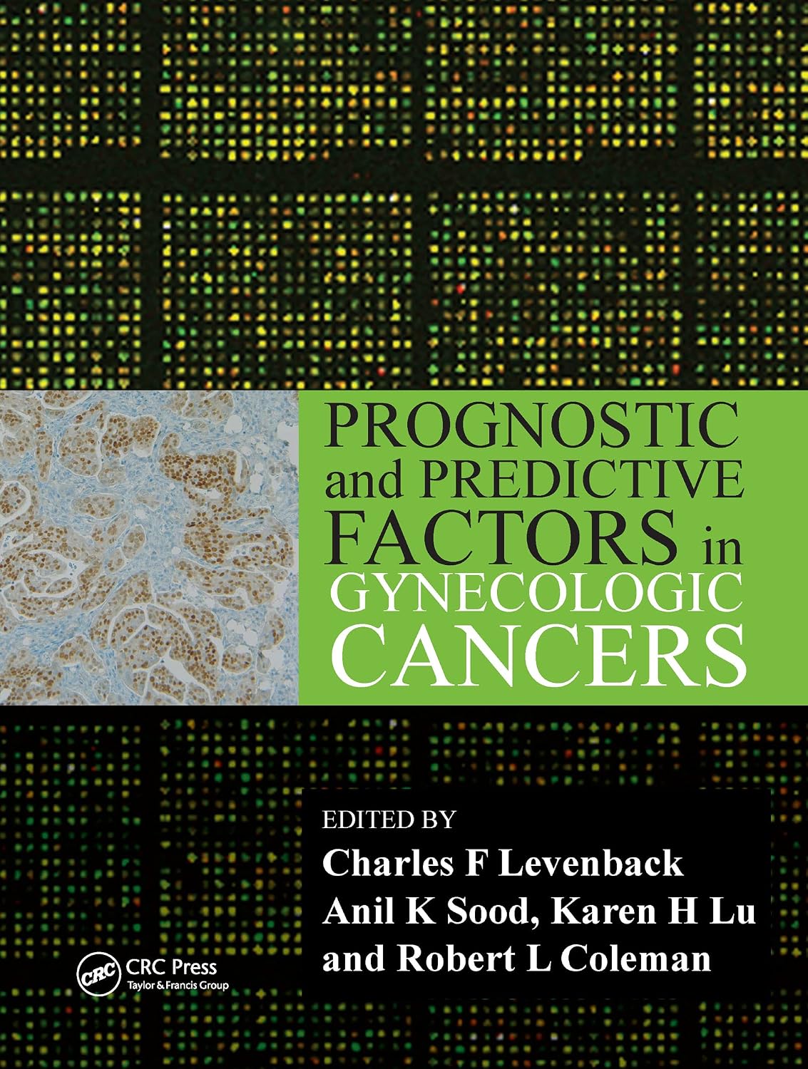 Prognostic and Predictive Factors in Gynecologic Cancers      1st Edition