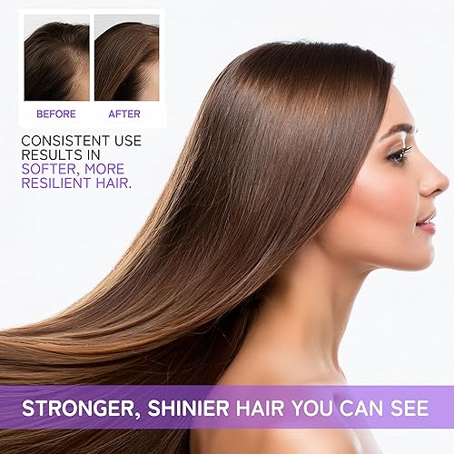 Miniatura 4 de KIT 100Timetros Antiadelgazamiento | AntiQueda FASHION GOLD