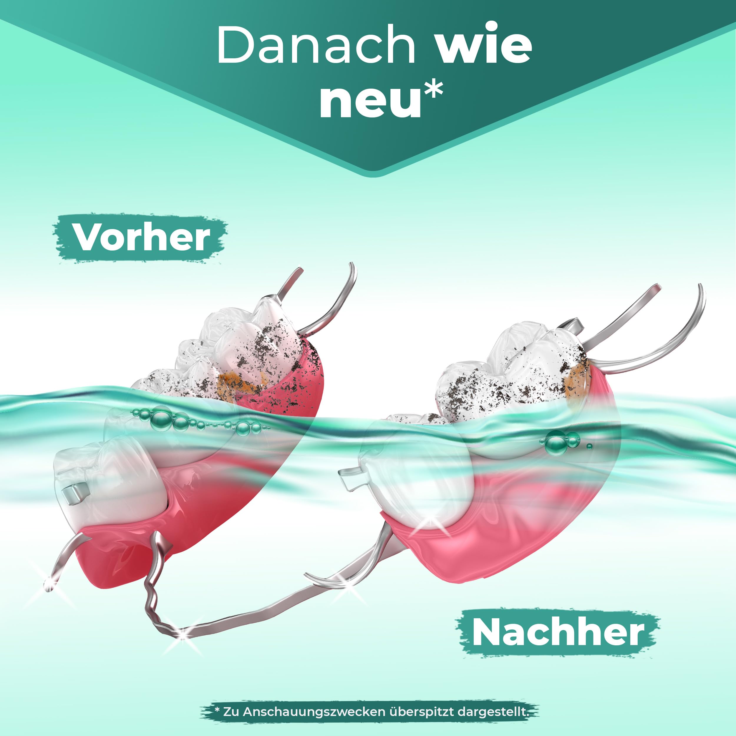 Prothetik & Dental Ultraschallreiniger Konzentrat, Effektive Reinigung für Dentalprodukte, Ultraschall Dentalreiniger, Zahnprothesen (3 Liter)