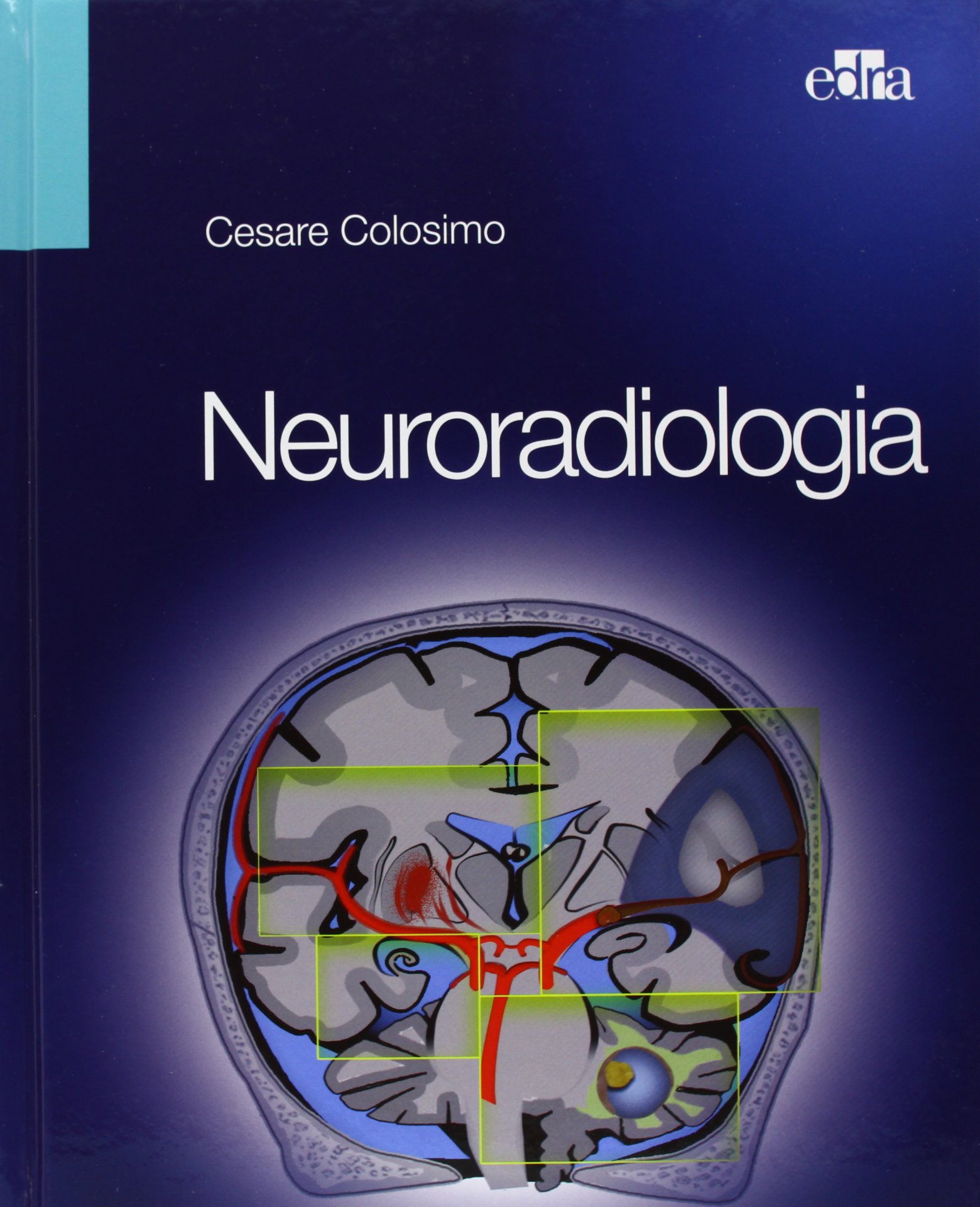 Neuroradiologia