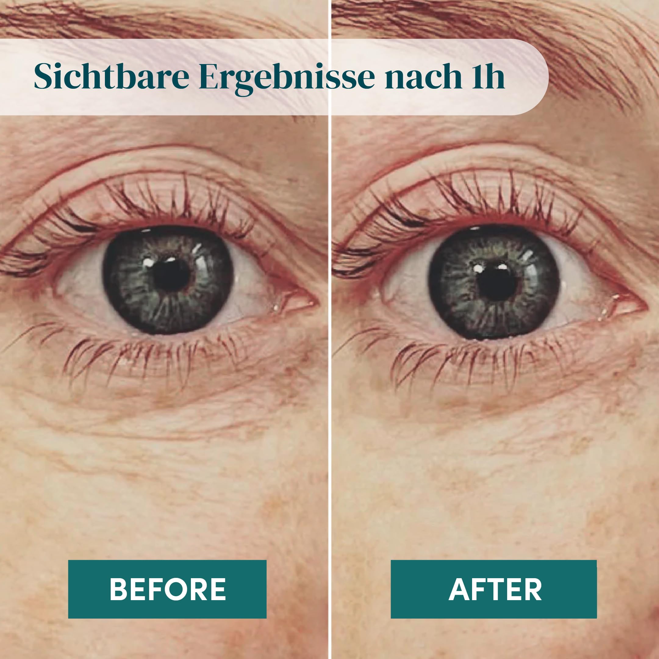 APRICOT Augenpads mit Hyaluron I bis zu 30x verwendbar I Anti-Aging Eye Pads "Me,Myself and Eye" I Mindert Augenfalten I Silikon Pads gegen Falten I Made in Germany