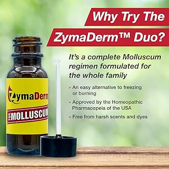 ZymaDerm 10 Amazing Benefits Of This Powerful Molluscum 52 OFF AC UF350,350 QL80