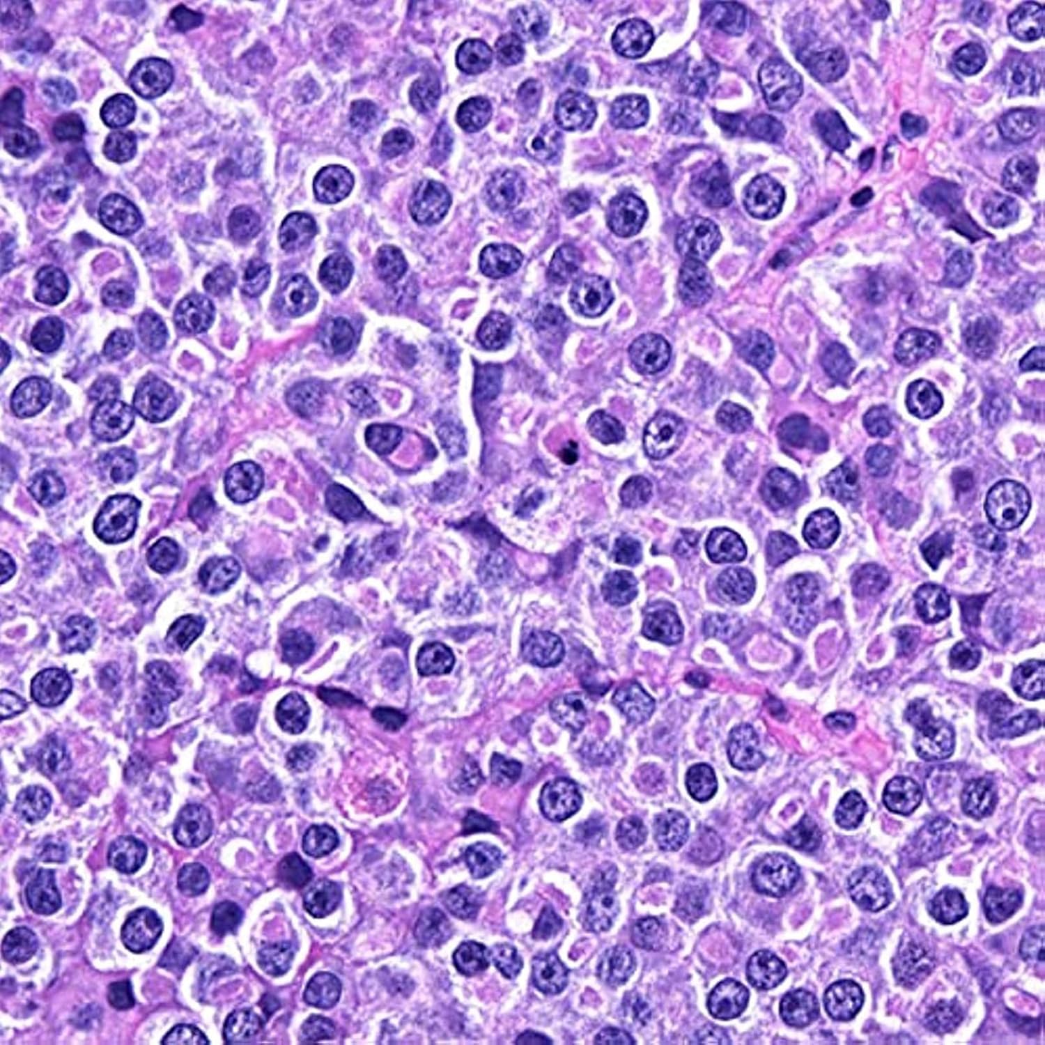 50pcs Hum Patológica Portaobjetos De Microscopio con Muestras, Secciones Patológicas Médicas Portaobjetos De Microscopio, Portaobjetos De Histología para Educación De Estudios Médicos
