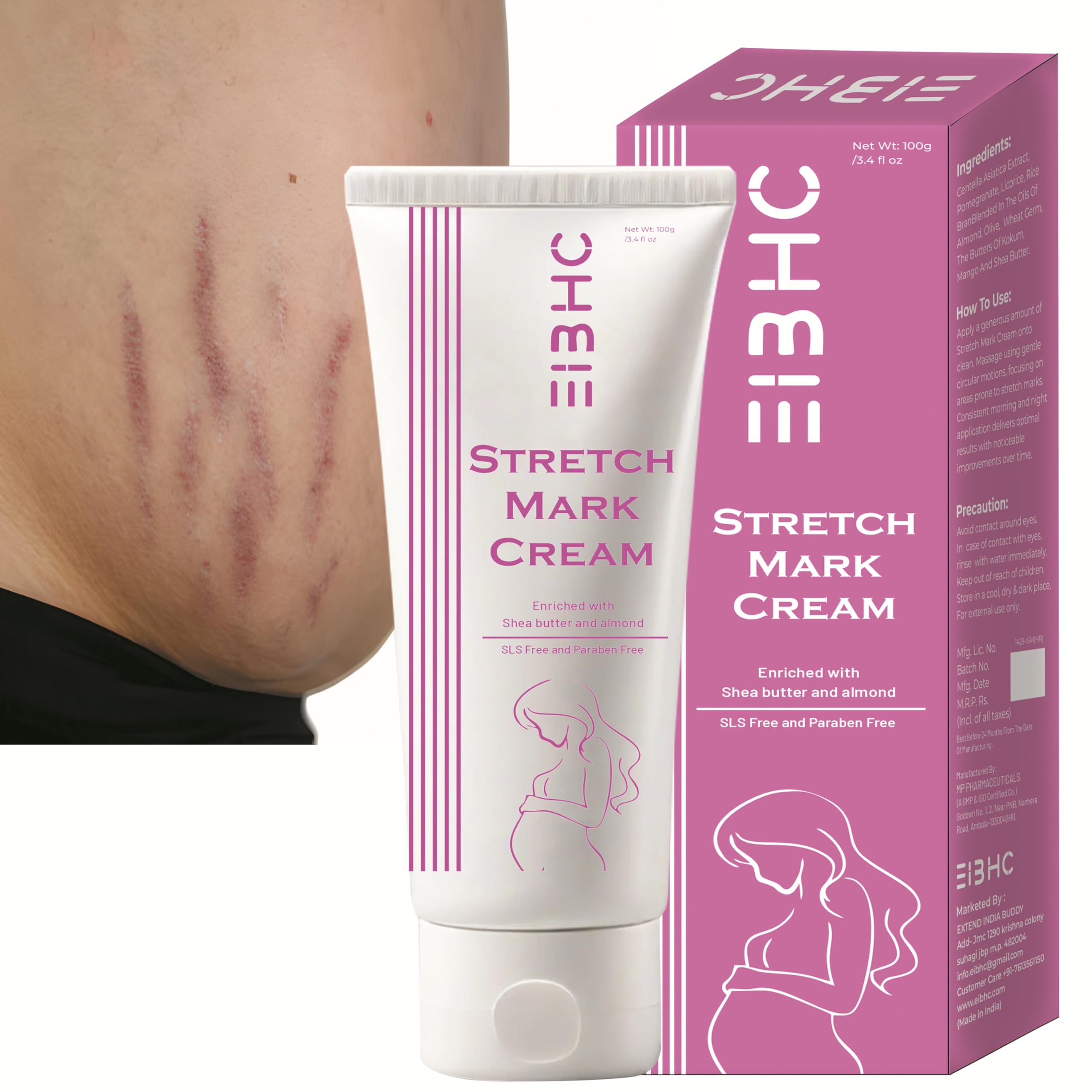 EIBHC Stretch Marks Removal Effective stretch mark Cream during & After pregnancy reduction with all body parts Skin (100g)