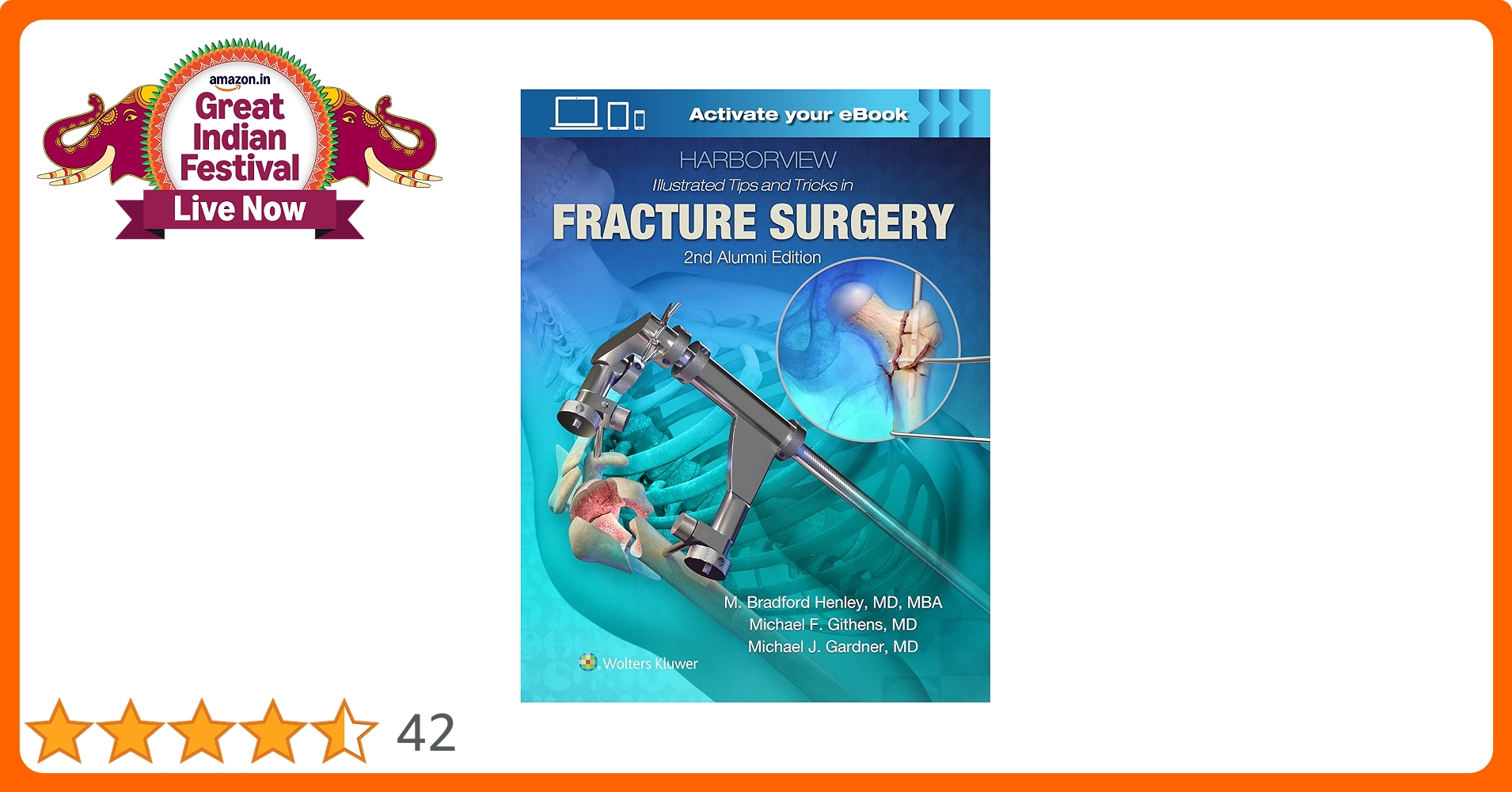 Buy Harborview Illustrated Tips And Tricks In Fracture