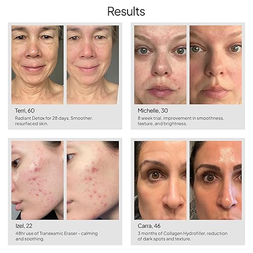 Miniatura 4 de Droplette Dispositivo Micro-Infusor (Winterberry)