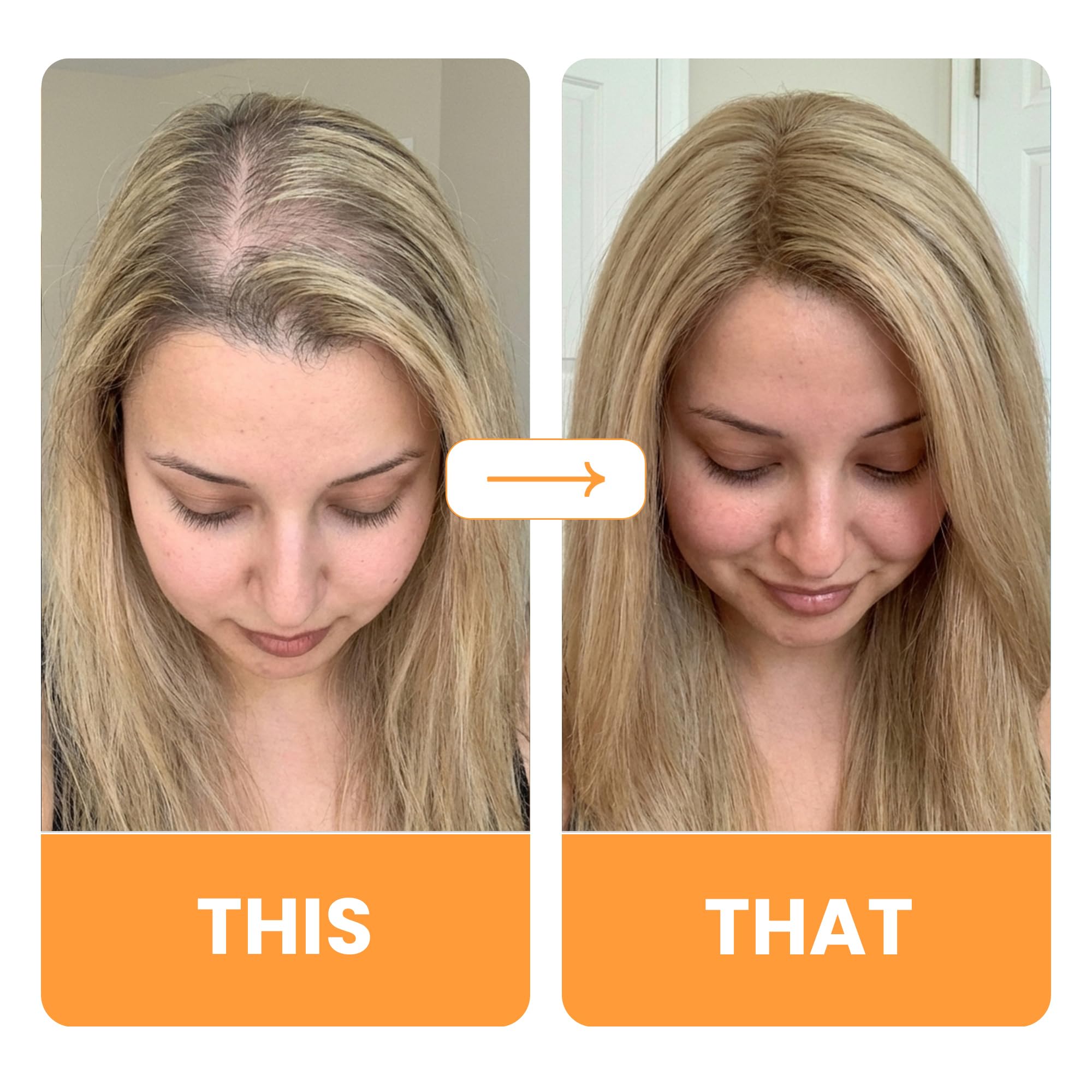 Vytadose Multivitamin Patches | Hair Growth for Women | Topical Daily Iron — Amazon image 6