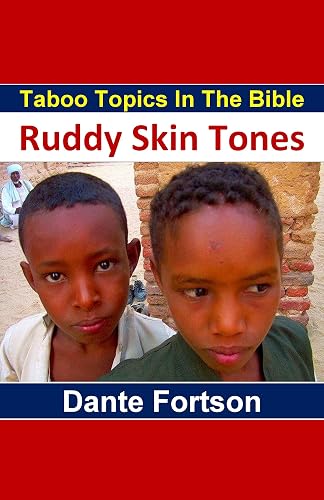 Taboo Topics In The Bible: Ruddy Skin (English Edition)