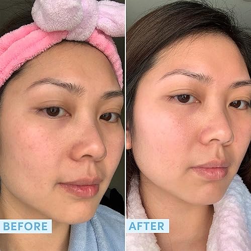 Miniatura 4 de Sand & Sky Suero de ácido hialurónico para la cara, suero hidratante con probióticos y algas marinas fermentadas, suero facial reductor de línea