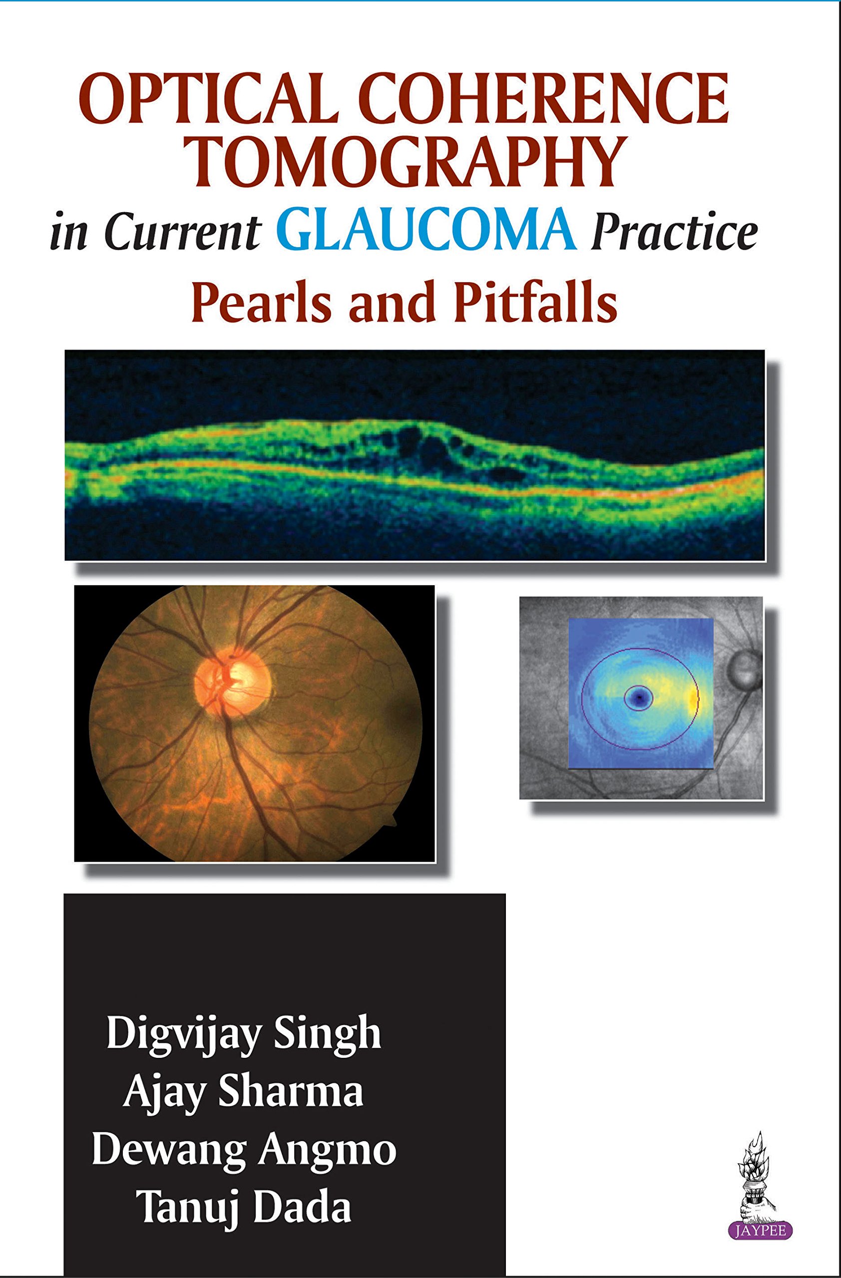 Buy Optical Coherence Tomography In Current Practice Pearls