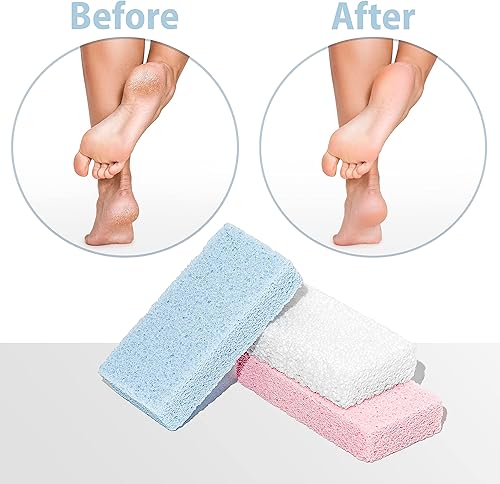 Miniatura 3 de Piedra pómez para pies  Paquete de 3 unidades de removedor de piel muerta  Piedra pómez de vidrio hecho en España para piel dura y removedor de
