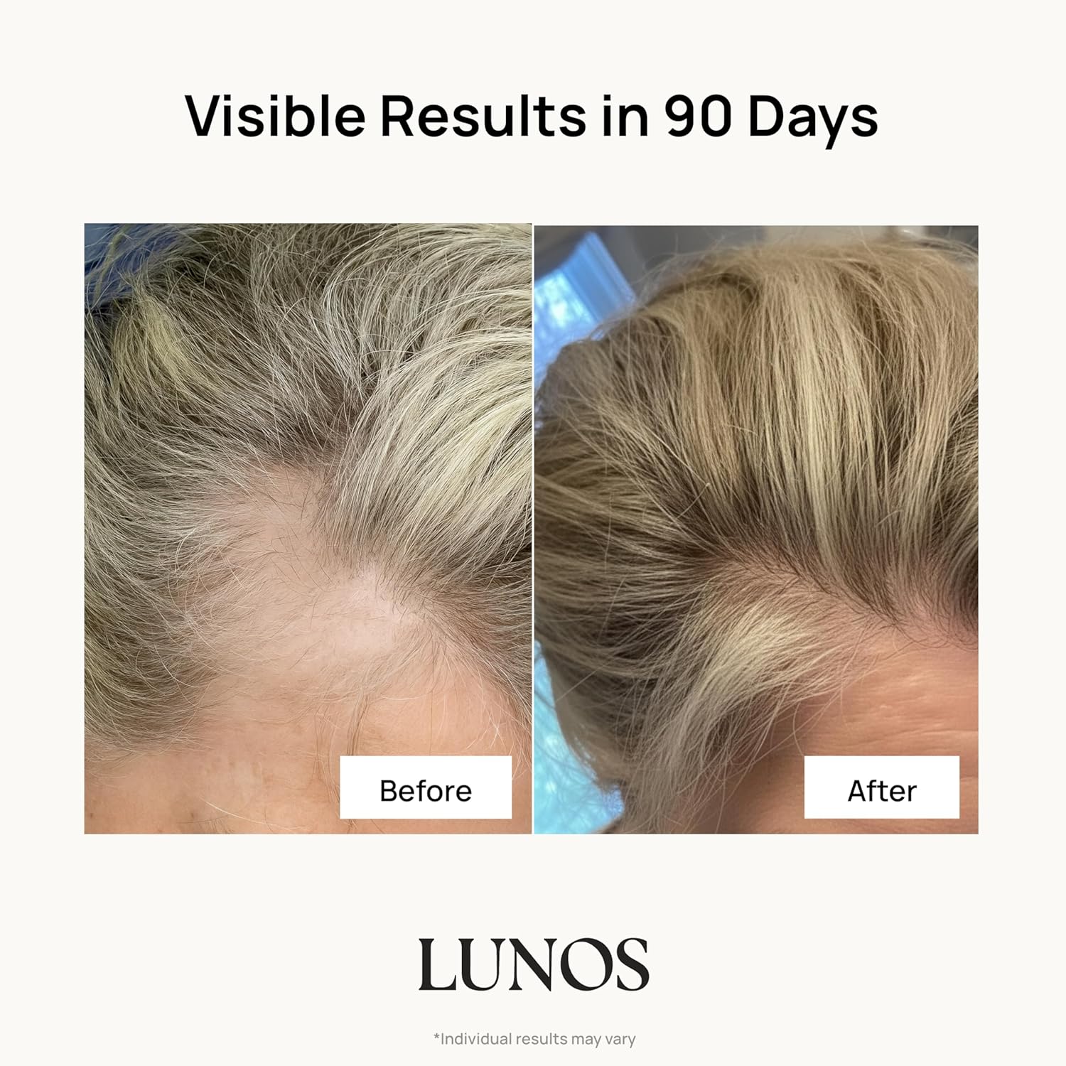 Lunos Grow Hair Growth Vitamins - 17 Ingredient Supplement with Biotin, Saw Palmetto, & Marine Collagen - Hair Growth Products for Women & Men - 1 Month Supply