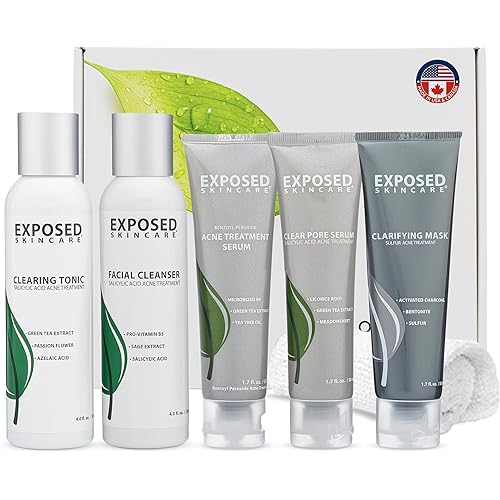 Exposed Skin Care, Acne Treatment Kit with 2.5% Salicylic Acid and 3.5% Benzoyl Peroxide to Clear Up Teen, Adult, Hormonal and Cystic Acne – Natural, Non-toxic and Cruelty Free