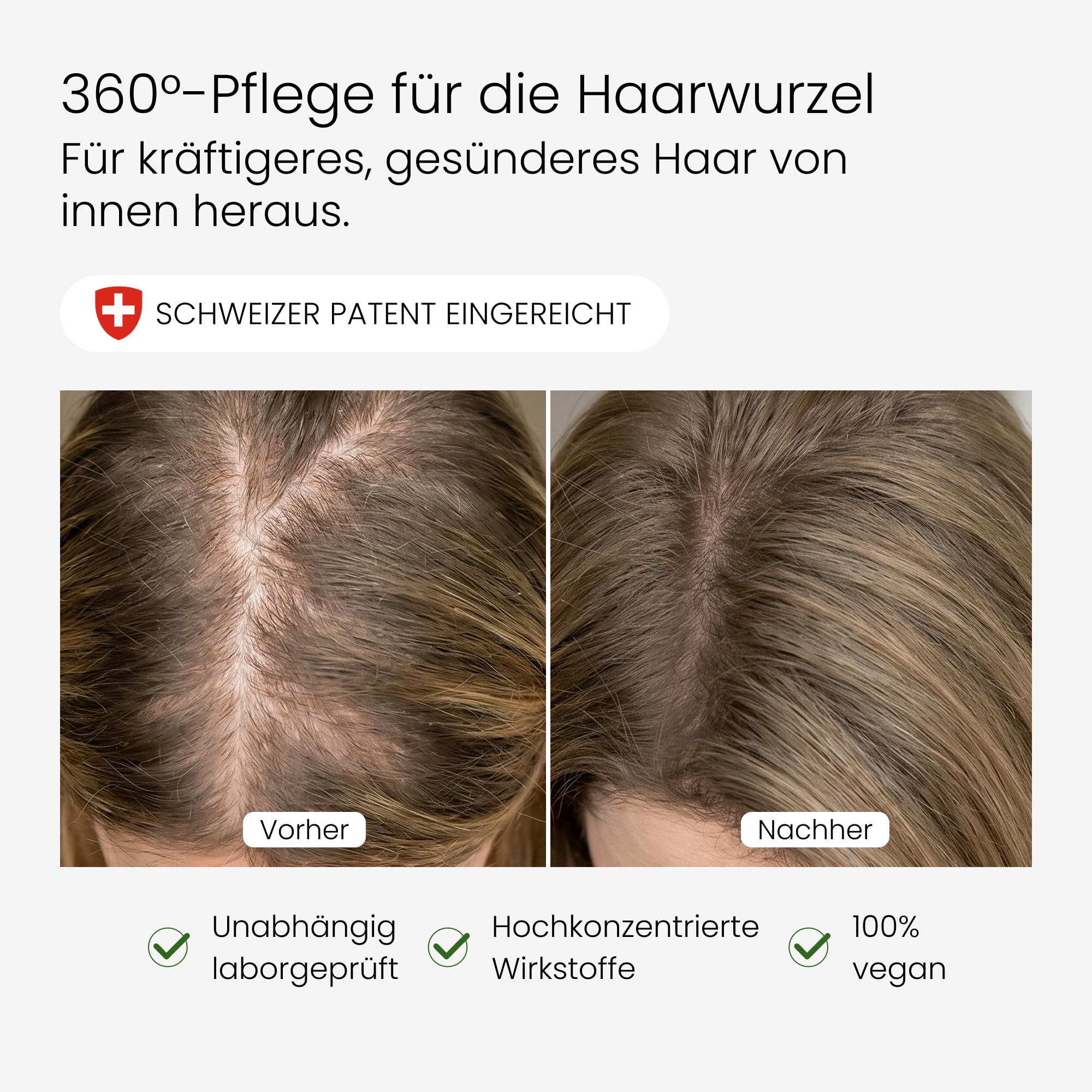 Haarkomplex für Frauen | Patentangemeldetes 360°-Haarsystem | Bei Haarausfall, dünner werdendem Haar & Haarbruch | Ayurveda-Kräuter + Schweizer Vitamine & Mineralstoffe | Vegan | 30 Kapseln
