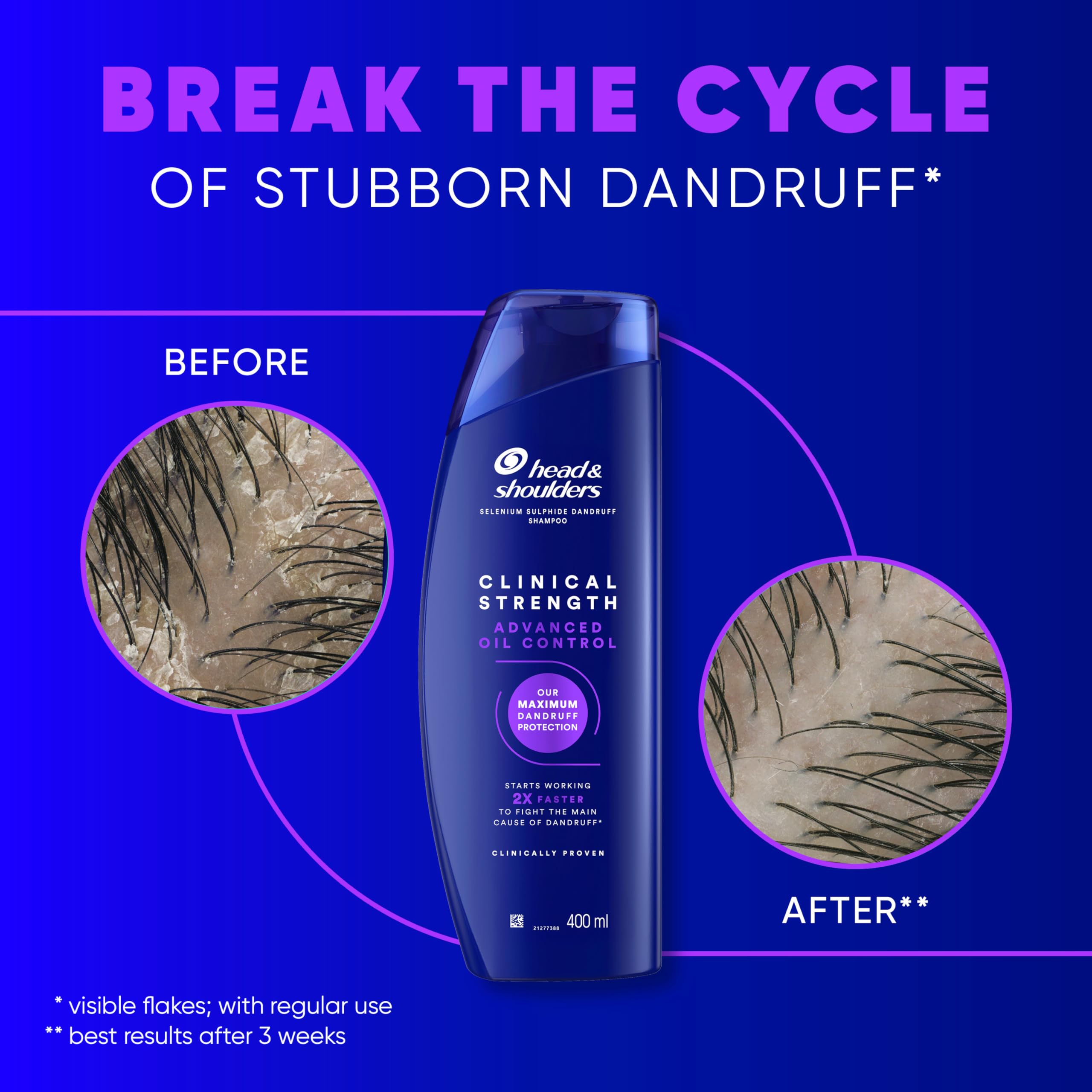 Head & Shoulders Advanced Oil Control 400ml Selenium Sulphide Anti-Dandruff Shampoo - Image 3