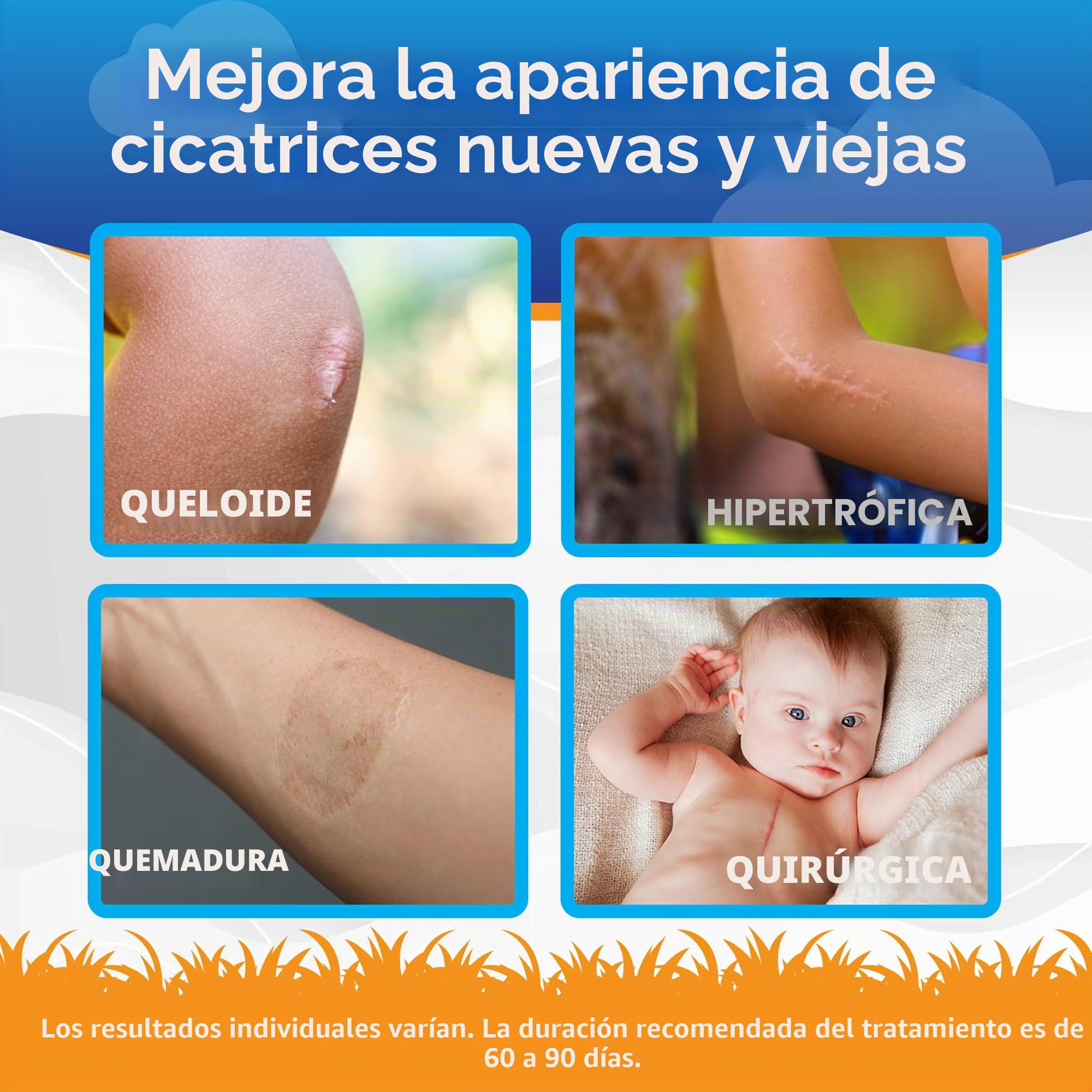 ScarAway Gel de silicona para cicatrices para niños, 100% de grado médico, ayuda a mejorar el tamaño, el color y la textura de las cicatrices hipertróficas y queloides en la cara y el cuerpo causadas