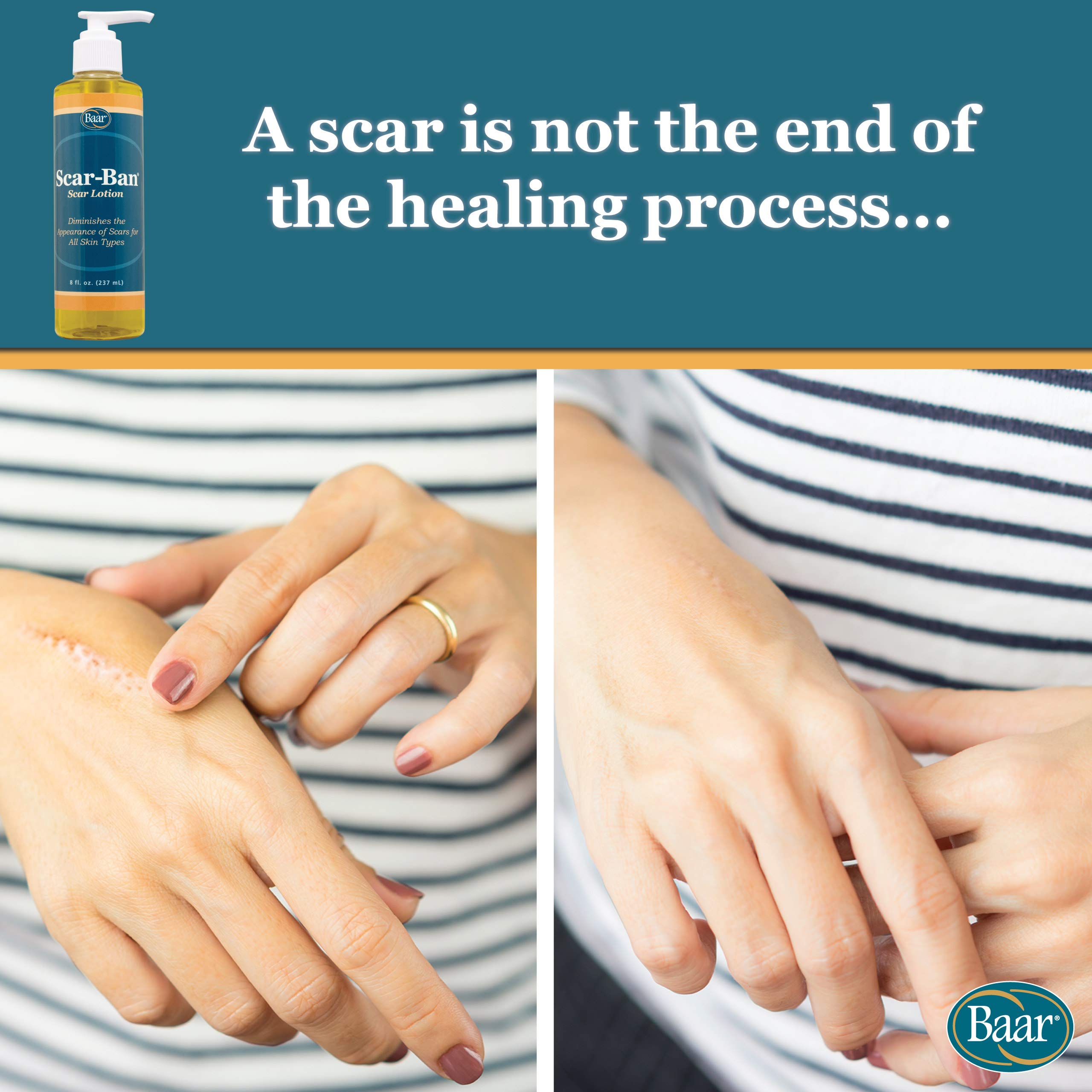 Baar Scar Ban Pump, 8 oz — Amazon image 2