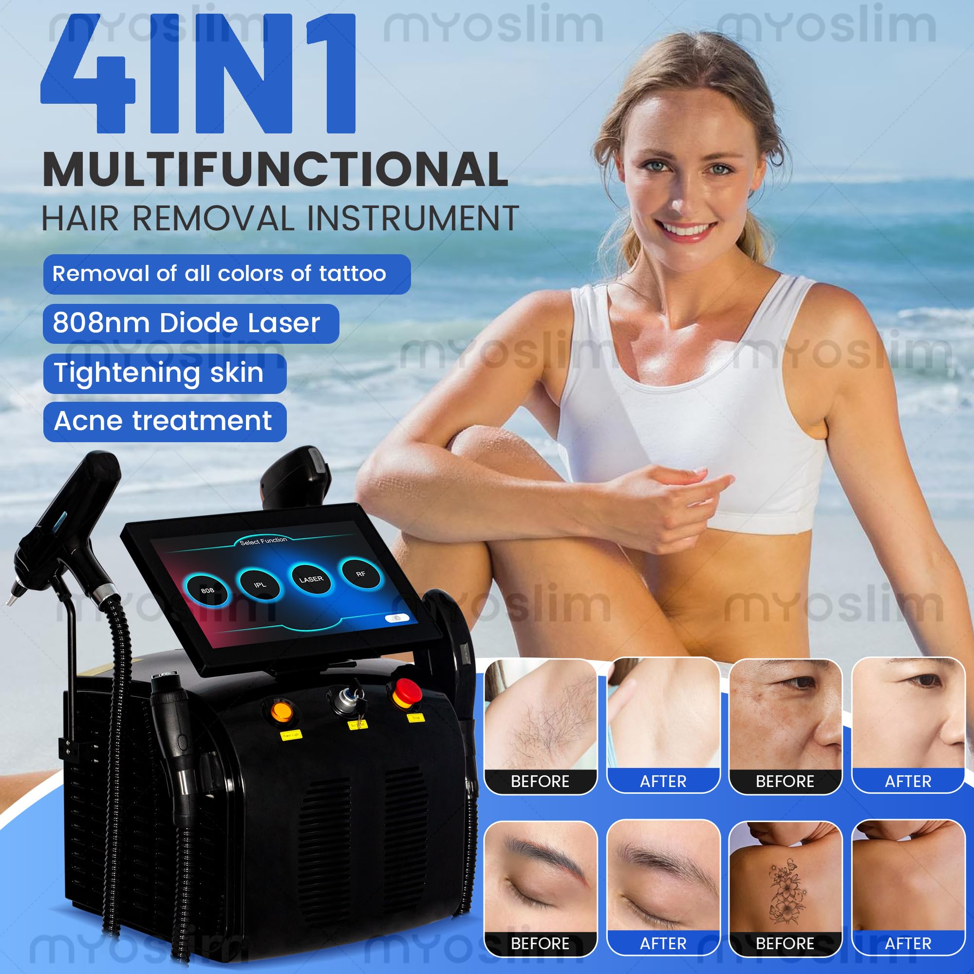 Professionelles 4 in 1 Haarentfernungsgerät | 808nm Diodenlaser Kosmetikgerät mit IPL RF, professionelles Hautpflege- und Straffungsgerät