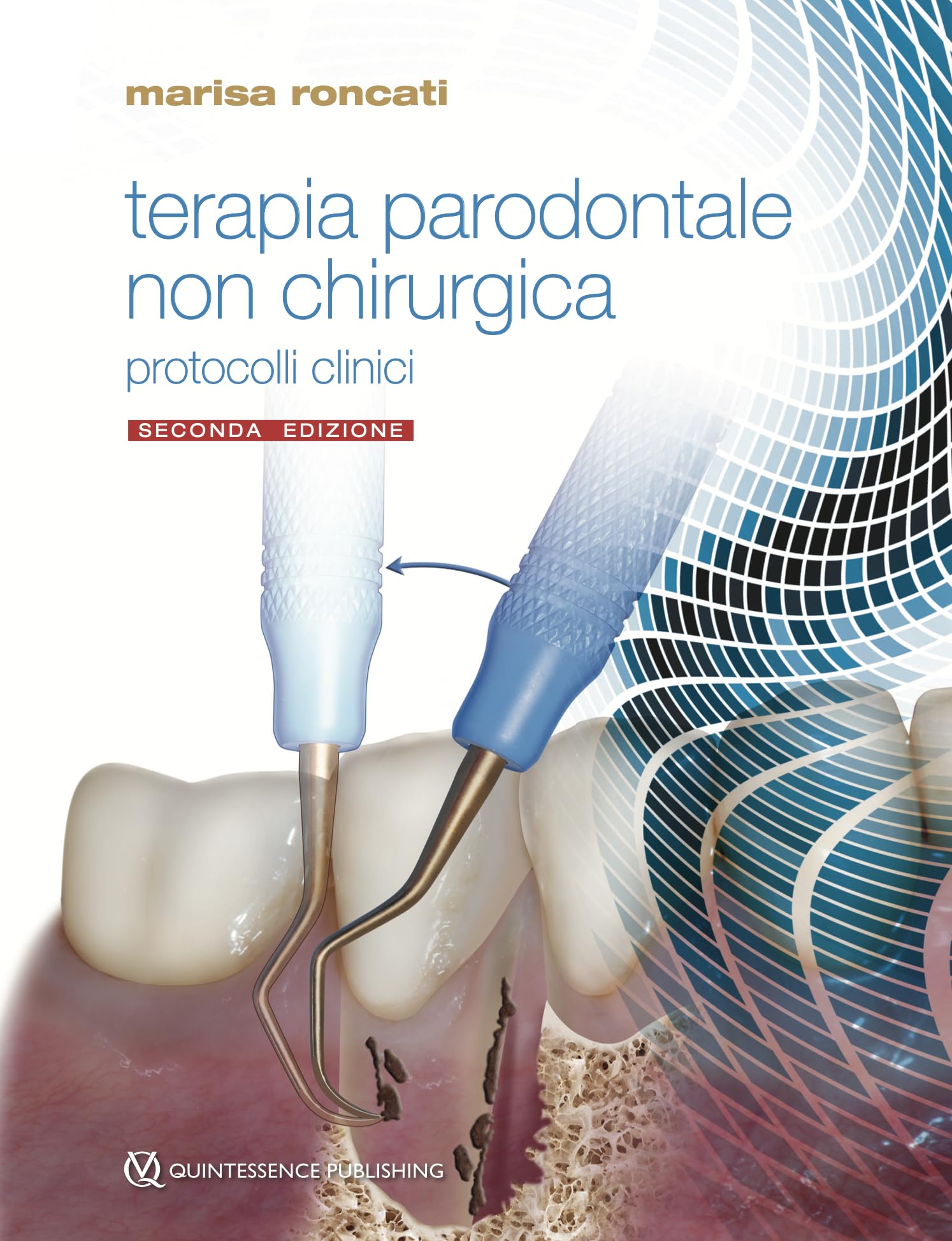 Terapia parodontale non chirurgica. Indicazioni, limiti e protocolli clinici con l'uso aggiuntivo del laser a diodo