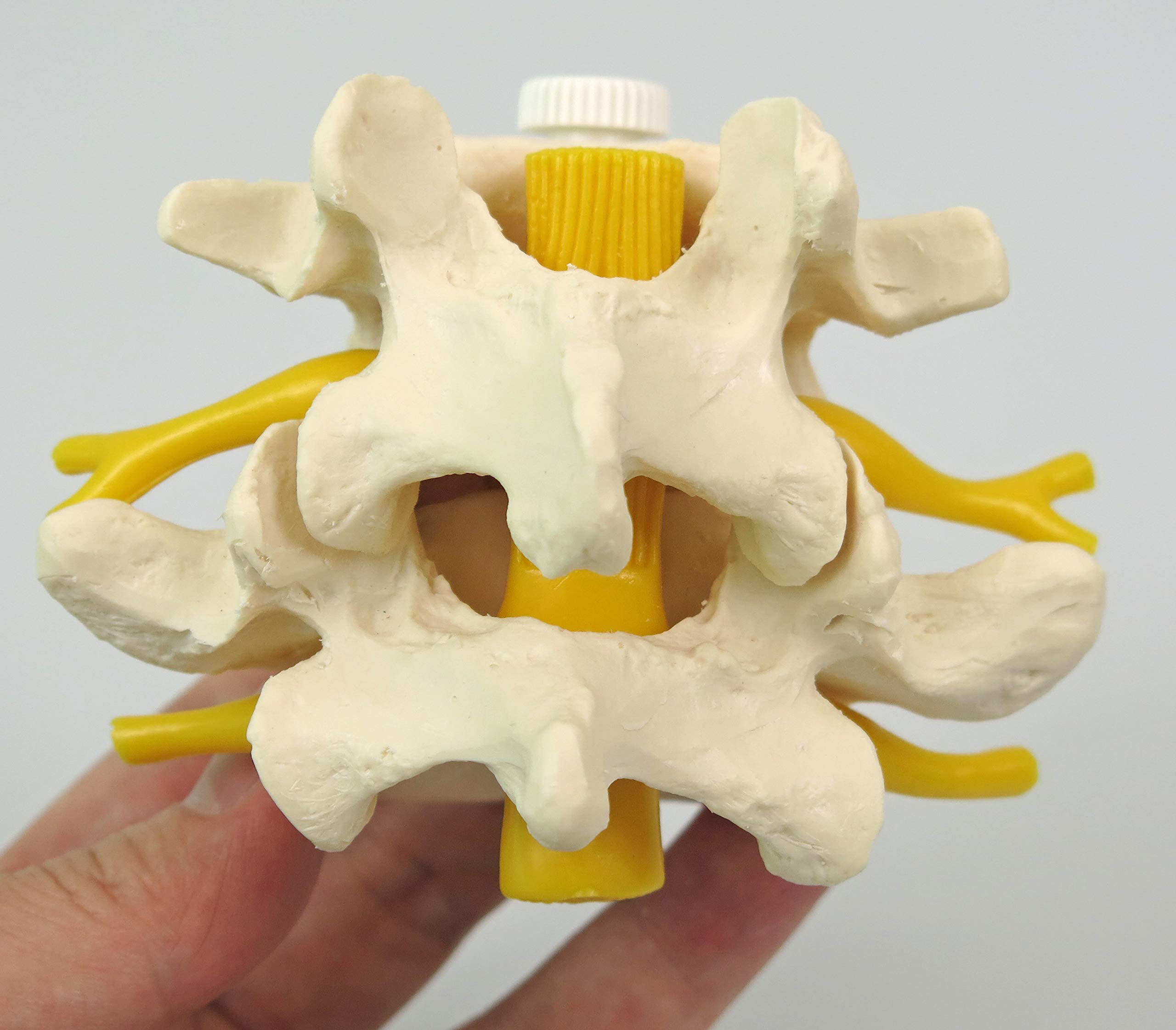 3B Scientific® 2 Vertèbres Lombaires avec Hernie Discale – Modèles Anatomiques Montés de Manière Flexible + Smart Anatomy App (Garantie de 5 Ans)