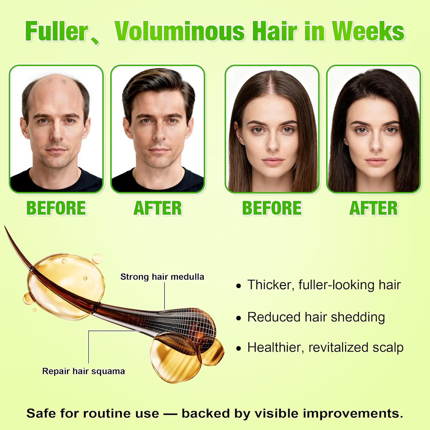 Hair Regrowth System, Advanced Hair Growth Treatment Serum with Ginseng, Eclipta Prostrata, Peppermint Oil & Ginger Root, Hair growth & Hair fall control serum for Women & Men - Image 3