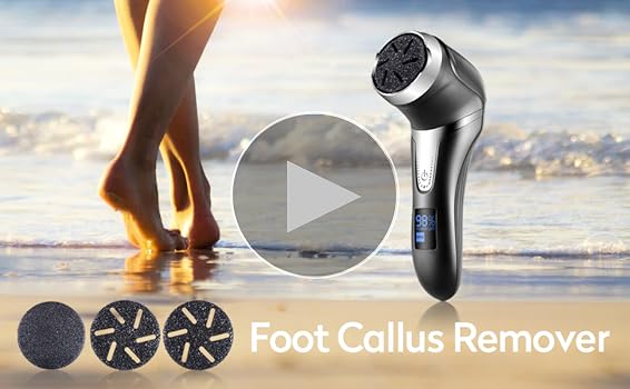 Amazon.com : Electric Callus Remover for Feet with Vacuum