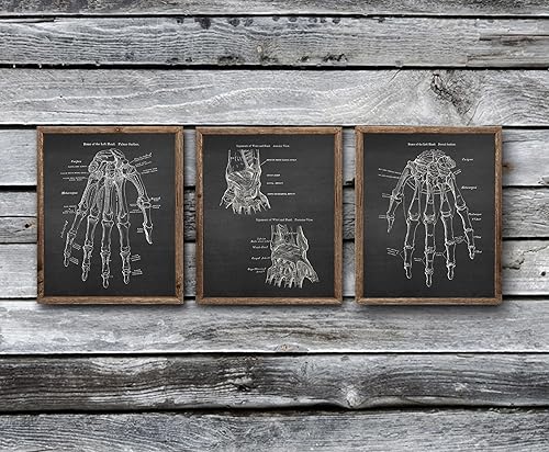 Miniatura 2 de Gnosis Picture Archive Anatomía de huesos de mano médica, juego de 3 impresiones artísticas sin marco, decoración ortopédica de oficina