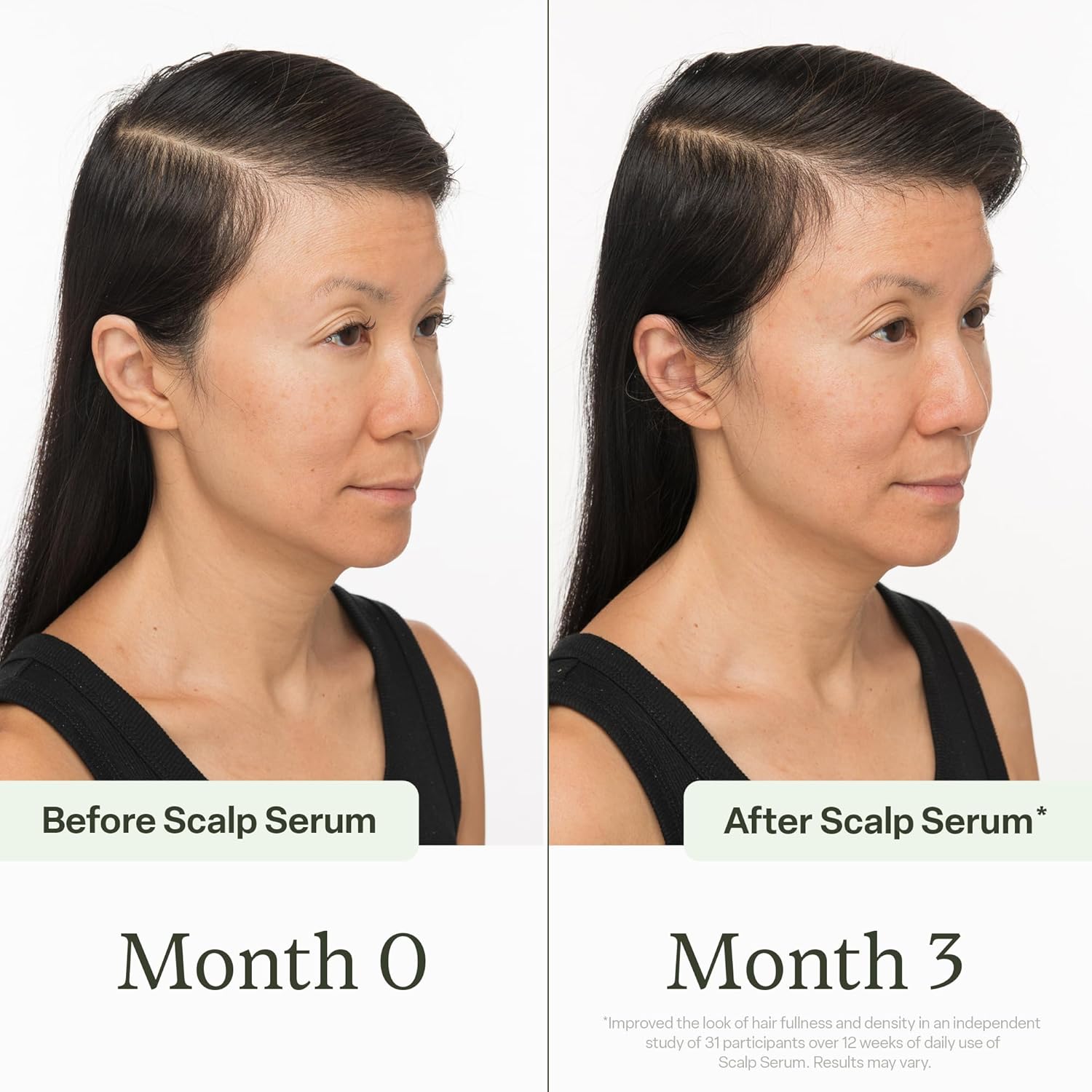 Divi Daily Growth System – Includes Scalp Serum (30ml) & Hair Vitamins (60 Count) – Targets Shedding, Supports Growth & Nourishes Follicles for Fuller, Thicker, Healthy-Looking, 2 Piece Set