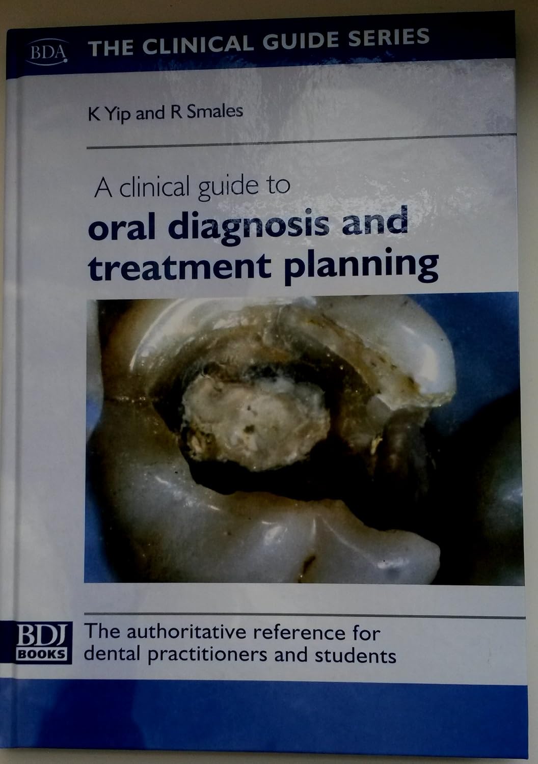 A Clinical Guide to Oral Diagnosis and Treatment Planning BDJ: Amazon ...