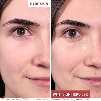 Erborian Skin Hero Eye Cream, De-Puffing, Dark Circles, Korean Skincare